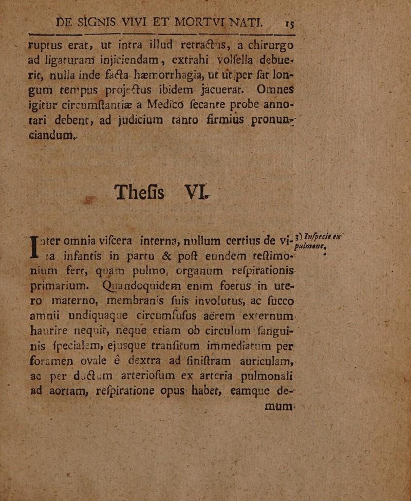 1 Pot k^ SEMES 3E ut Y - TEES AD X DAD H - 4 i i ^ UR » ANE rd Thes NE D «t T Nd -puimene, X ia infantis: in partu &amp; poft. eundem teftimo- — * ad orar ) refpiratione opas: habet, eamque de- ? ? i &amp;. 35 wf | P