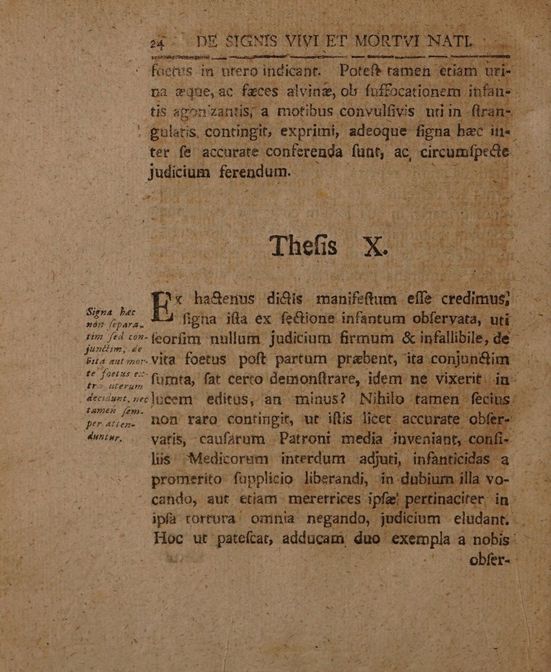 na : durs ac Kfices Borm pl. pus pco tis aponzantisy a motibus. convul&amp; vis ur in-flrans- ' gl stis. contingit, exprimi, adeoque figna bec dfe. | ter f&amp; accurate: conferenda: MM: ac, pcumípede - Judicium. ferendum. UNE -- Piet iila e ex. deBloue: pene cia ed ys nei *-feorfim nullum. judicium. firmum. &amp; infallibile, de $i sco. Vita foetus. poft partum. prabent,- ita -conjum&amp;im . n. f ^ ^^ fümta, fat certo demonftrare, idem ne vixerit. j cA dede, ves fü&amp;em editus, an- aminust Nihilo - tamen. fcis praus. hon rato Contingit, mt. Aftis. licet. accurate « € jbfe 4e. vatis, caufárum Patroni media i inveniant, dis: Medicorem interdum - adjuti, infantic promerito: fupplicio liberandi, dn-dubium i cando, sut etiam. meretrices. ipfaz pertinac it ipfa torrura' oninia negando, judicium - eludant;- LS jc ut t pateftat, adducam duo MUR a nobis - Wut | AME NOD Lou ro | ? -