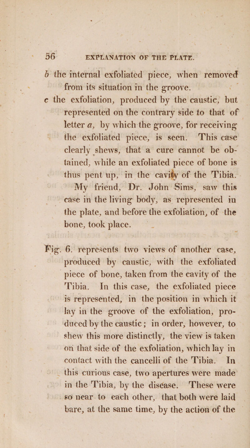 b the internal exfoliated piece, when removed from its situation in the groove. c the exfoliation, produced by the caustic, but represented on the contrary side to that of letter a, by which the groove, for receiving the exfoliated piece, is seen. This case clearly shews, that a cure cannot be ob¬ tained, while an exfoliated piece of bone is thus pent up, in the cavity of the Tibia. My friend. Dr. John Sims, saw this case in the living body, as represented in the plate, and before the exfoliation, of the bone, took place. Fig-. 6. represents two views of another case, produced by caustic, with the exfoliated piece of bone, taken from the cavity of the Tibia. In this case, the exfoliated piece is represented, in the position in which it lay in the groove of the exfoliation, pro¬ duced by the caustic; in order, however, to shew this more distinctly, the view is taken ori that side of the exfoliation, which lay in contact with the cancelli of the Tibia. In this curious case, two apertures were made in the Tibia, by the disease. These were so near to each other, that both were laid bare, at the same time, by the action of the