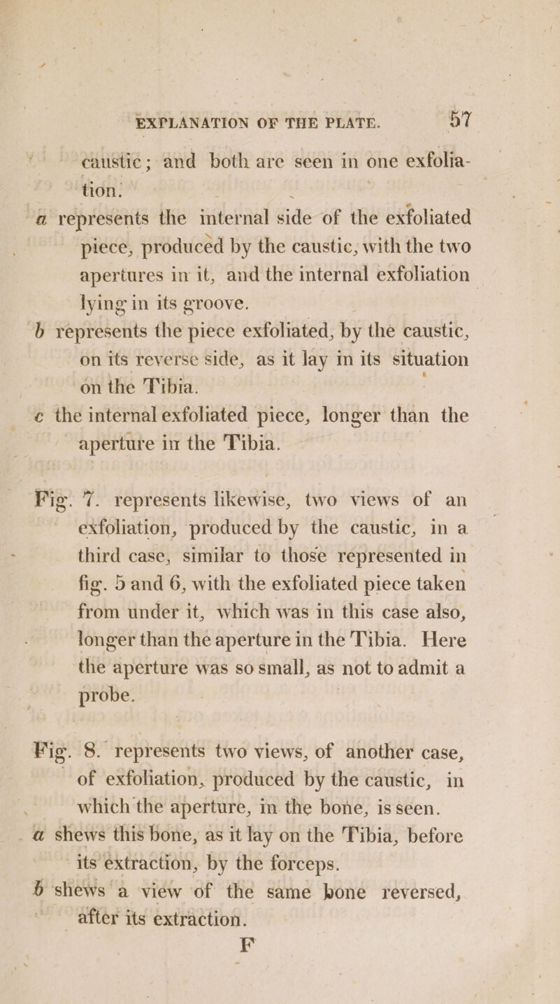 caustic; and both are seen in one exfolia¬ tion. # a represents the internal side of the exfoliated piece, produced by the caustic, with the two apertures in it, and the internal exfoliation lying in its groove. b represents the piece exfoliated, by the caustic, on its reverse side, as it lay in its situation on the Tibia. c the internal exfoliated piece, longer than the aperture in the Tibia. Fig. 7. represents likewise, two views of an exfoliation, produced by the caustic, in a third case, similar to those represented in \ fig. 5 and 6, with the exfoliated piece taken from under it, which was in this case also, longer than the aperture in the Tibia. Here the aperture was so small, as not to admit a probe. Pig. 8. represents two views, of another case, of exfoliation,, produced by the caustic, in which the aperture, in the bone, is seen. a shews this bone, as it lay on the Tibia, before its extraction, by the forceps. b shews a view of the same bone reversed, after its extraction. F