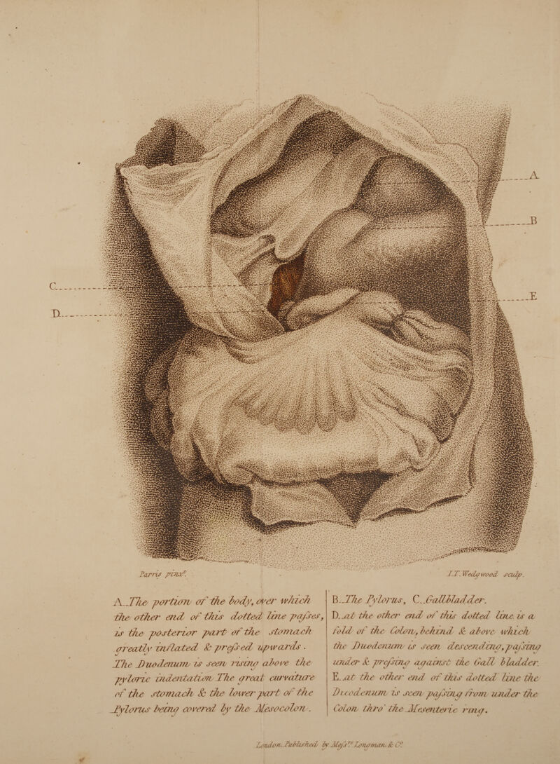 lilisfe mm SAr f.'jl-rts si HR! iaSlS £&§& V** J ipi 5Us- MTi , • V.K'-iC Parris pinxt. J-T. Wedc wood scalp. A. The portion of the body, over which the other end of this dotted line pafses, is the posterior port of the stomach oreaflv inflated Sc prefsed upwards . t- ts The Duodenum is seen- rismo above the i/ pvlorie indentation The areal curvature r if v- of the stomach Sc the lower part of the -Pylorus hemp covered by the Mesocolon . M illie Fvlorus, i..Gallbladder. is lint the other end of this dotted late u a fold of the Colon, behind & above- which the XDuodcmcnv is seen deseendmo, pa> sow under Sc pry sou? ay const the Call bladder. E. .at the other end of this dotted Hue the D tec demon is seen pcysuiq Horn under the colon thro the ^Mesenteric rimy. London,Sullukeel by Mejs rs hmornan,. & C°.