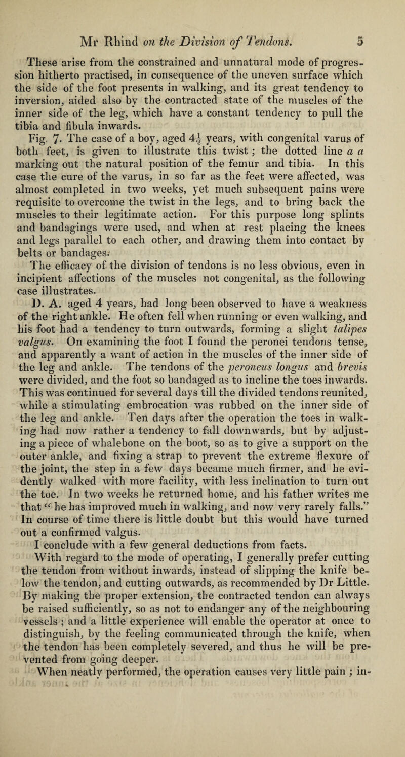 These arise from the constrained and unnatural mode of progres¬ sion hitherto practised, in consequence of the uneven surface which the side of the foot presents in walking, and its great tendency to inversion, aided also bv the contracted state of the muscles of the inner side of the leg, which have a constant tendency to pull the tibia and fibula inwards. Fig. 7- The case of a boy, aged 4^ years, with congenital varus of both feet, is given to illustrate this twist; the dotted line a a marking out the natural position of the femur and tibia. In this case the cure of the varus, in so far as the feet W’ere affected, was almost completed in two weeks, yet much subsequent pains were requisite to overcome the twist in the legs, and to bring back the muscles to their legitimate action. For this purpose long splints and bandagings were used, and when at rest placing the knees and legs parallel to each other, and drawing them into contact bv belts or bandages. The efficacy of the division of tendons is no less obvious, even in incipient affections of the muscles not congenital, as the following case illustrates. D. A. aged 4 years, had long been observed to have a weakness of the right ankle. He often fell when running or even walking, and his foot had a tendency to turn outwards, forming a slight talipes valgus. On examining the foot I found the peronei tendons tense, and apparently a want of action in the muscles of the inner side of the leg and ankle. The tendons of the peroneus longus and brevis were divided, and the foot so bandaged as to incline the toes inwards. This was continued for several days till the divided tendons reunited, while a stimulating embrocation was rubbed on the inner side of the leg and ankle. Ten days after the operation the toes in walk¬ ing had now rather a tendency to fall downwards, but by adjust¬ ing a piece of whalebone on the boot, so as to give a support on the outer ankle, and fixing a strap to prevent the extreme flexure of the joint, the step in a few days became much firmer, and he evi¬ dently walked with more facility, with less inclination to turn out the toe. In two weeks he returned home, and his father writes me thathe has improved much in walking, and now very rarely falls.” In course of time there is little doubt but this would have turned out a confirmed valgus. I conclude with a few general deductions from facts. With regard to the mode of operating, I generally prefer cutting the tendon from without inwards, instead of slipping the knife be¬ low the tendon, and cutting outwards, as recommended by Dr Little. By making the proper extension, the contracted tendon can always be raised sufficiently, so as not to endanger any of the neighbouring vessels ; and a little experience will enable the operator at once to distinguish, by the feeling communicated through the knife, when the tendon has been completely severed, and thus he will be pre¬ vented from going deeper. When neatly performed, the operation causes very little pain ; in-