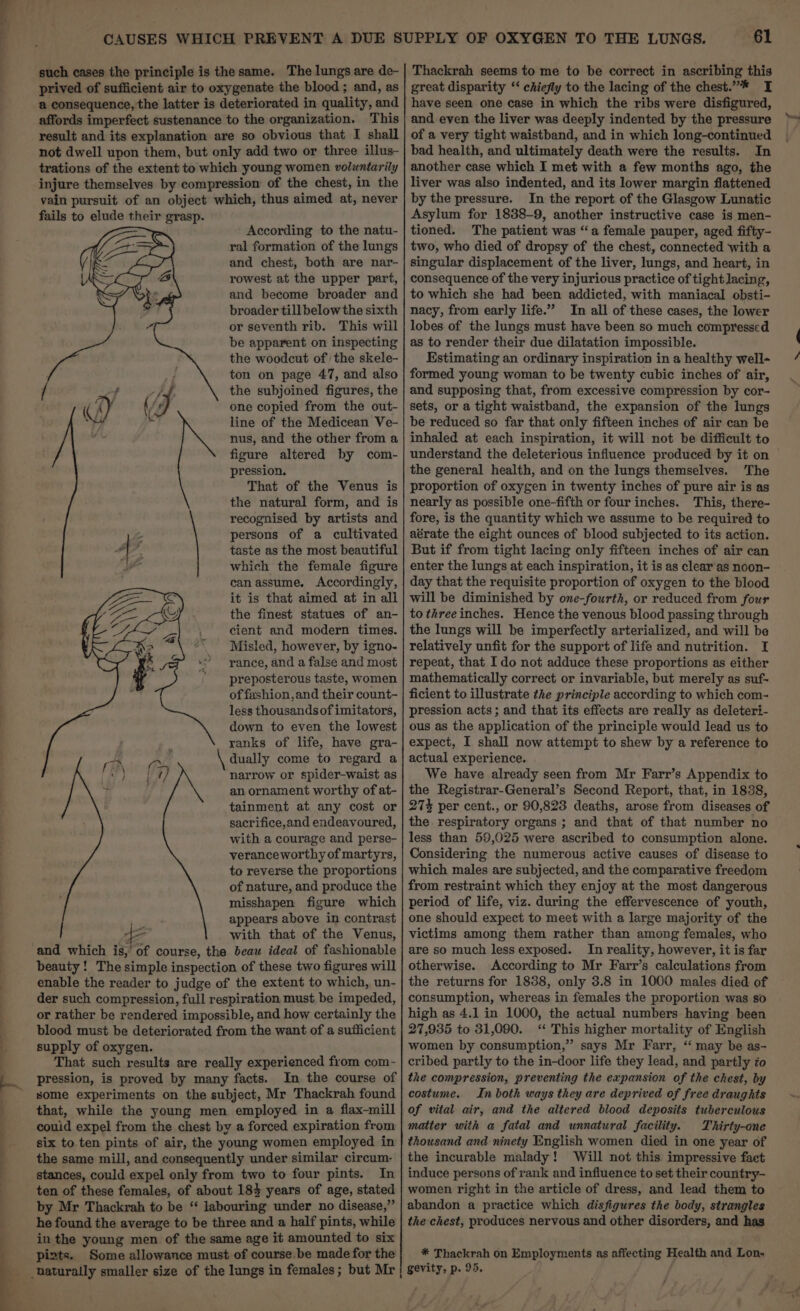 — such cases the principle is the same. The lungs are de- prived of sufficient air to oxygenate the blood; and, as a consequence, the latter is deteriorated in quality, and affords imperfect sustenance to the organization. This result and its explanation are so obvious that I shall not dwell upon them, but only add two or three illus- trations of the extent to which young women voluntarily injure themselves by compression of the chest, in the vain pursuit of an object which, thus aimed at, never fails to elude their grasp. « According to the natu- _ ral formation of the lungs and chest, both are nar- rowest at the upper part, and become broader and broader till below the sixth or seventh rib. This will be apparent on inspecting the woodcut of the skele- ton on page 47, and also the subjoined figures, the fs one copied from the out- 4 line of the Medicean Ve- nus, and the other from a figure altered by com- pression. That of the Venus is the natural form, and is recognised by artists and persons of a cultivated taste as the most beautiful which the female figure it is that aimed at in all the finest statues of an- cient and modern times. Misled, however, by igno- rance, and a false and most preposterous taste, women of fashion,and their count- less thousandsof imitators, down to even the lowest ranks of life, have gra- \ dually come to regard a narrow or spider-waist as an ornament worthy of at- tainment at any cost or sacrifice,and endeavoured, with a courage and perse- veranceworthy of martyrs, to reverse the proportions of nature, and produce the misshapen figure which appears above in contrast with that of the Venus, beauty! The simple inspection of these two figures will enable the reader to judge of the extent to which, un- der such compression, full respiration must be impeded, or rather be rendered impossible, and how certainly the blood must be deteriorated from the want of a sufficient supply of oxygen. That such results are really experienced from com- pression, is proved by many facts. In the course of some experiments on the subject, Mr Thackrah found that, while the young men employed in a flax-mill couid expel from the chest by a forced expiration from six to ten pints of air, the young women employed in the same mill, and consequently under similar circum- stances, could expel only from two to four pints. In ten of these females, of about 184 years of age, stated by Mr Thackrah to be “ labouring under no disease,” he found the average to be three and a half pints, while in the young men of the same age it amounted to six pizts. Some allowance must of course.be made for the 61 Thackrah seems to me to be correct in ascribing this great disparity ‘‘ chiefly to the lacing of the chest.”* I have seen one case in which the ribs were disfigured, and even the liver was deeply indented by the pressure of a very tight waistband, and in which long-continued bad health, and ultimately death were the results. In another case which I met with a few months ago, the liver was also indented, and its lower margin flattened by the pressure. In the report of the Glasgow Lunatic Asylum for 1838-9, another instructive case is men- tioned. The patient was “a female pauper, aged fifty- two, who died of dropsy of the chest, connected with a singular displacement of the liver, lungs, and heart, in consequence of the very injurious practice of tight lacing, to which she had been addicted, with maniacal obsti- nacy, from early life.” In all of these cases, the lower lobes of the lungs must have been so much compressed as to render their due dilatation impossible. Estimating an ordinary inspiration in a healthy well- formed young woman to be twenty cubic inches of air, and supposing that, from excessive compression by cor- sets, or a tight waistband, the expansion of the lungs be reduced so far that only fifteen inches of air can be inhaled at each inspiration, it will not be difficult to understand the deleterious influence produced by it on | the general health, and on the lungs themselves. The proportion of oxygen in twenty inches of pure air is as nearly as possible one-fifth or four inches. This, there- fore, is the quantity which we assume to be required to aérate the eight ounces of blood subjected to its action. But if from tight lacing only fifteen inches of air can enter the lungs at each inspiration, it is as clear'as noon- day that the requisite proportion of oxygen to the blood will be diminished by one-fourth, or reduced from four to three inches. Hence the venous blood passing through the lungs will be imperfectly arterialized, and will be relatively unfit for the support of life and nutrition. I repeat, that Ido not adduce these proportions as either mathematically correct or invariable, but merely as suf- ficient to illustrate the principle according to which com- pression acts; and that its effects are really as deleteri- ous as the application of the principle would lead us to expect, I shall now attempt to shew by a reference to actual experience. We have already seen from Mr Farr’s Appendix to the Registrar-General’s Second Report, that, in 1838, 27% per cent., or 90,823 deaths, arose from diseases of the respiratory organs ; and that of that number no less than 59,025 were ascribed to consumption alone. Considering the numerous active causes of disease to which males are subjected, and the comparative freedom from restraint which they enjoy at the most dangerous period of life, viz. during the effervescence of youth, one should expect to meet with a large majority of the victims among them rather than among females, who are so much less exposed. In reality, however, it is far otherwise. According to Mr Farr’s calculations from the returns for 1838, only 3.8 in 1000 males died of consumption, whereas in females the proportion was so high as 4.1 in 1000, the actual numbers having been 27,935 to 31,090. ‘ This higher mortality of English women by consumption,” says Mr Farr, “ may be as- cribed partly to the in-door life they lead, and partly zo the compression, preventing the expansion of the chest, by costume. In both ways they are deprived of free draughts of vital air, and the altered blood deposits tuberculous matter with a fatal and unnatural facility. Thirty-one thousand and ninety English women died in one year of the incurable malady! ‘Will not this impressive faet induce persons of rank and influence to set their country- women right in the article of dress, and lead them to abandon a practice which disfigures the body, strangles the chest, produces nervous and other disorders, and has * Thackrah on Employments as affecting Health and Lon.