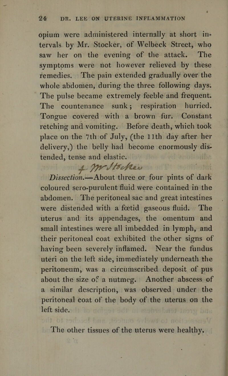 opium were administered internally at short in¬ tervals by Mr. Stocker, of Welbeck Street, who saw her on the evening of the attack. The symptoms were not however relieved by these remedies. The pain extended gradually over the whole abdomen, during the three following days. The pulse became extremely feeble and frequent. The countenance sunk; respiration hurried. Tongue covered with a brown fur. Constant retching and vomiting. Before death, which took place on the 7th of July, (the 11th day after her delivery,) the belly had become enormously dis¬ tended, tense and elastic. Dissection.—About three or four pints of dark coloured sero-purulent fluid were contained in the abdomen. The peritoneal sac and great intestines were distended with a foetid gaseous fluid. The uterus and its appendages, the omentum and small intestines were all imbedded in lymph, and their peritoneal coat exhibited the other signs of having been severely inflamed. Near the fundus uteri on the left side, immediately underneath the peritoneum, was a circumscribed deposit of pus about the size of a nutmeg. Another abscess of a similar description, was observed under the peritoneal coat of the body of the uterus on the left side. The other tissues of the uterus were healthy.