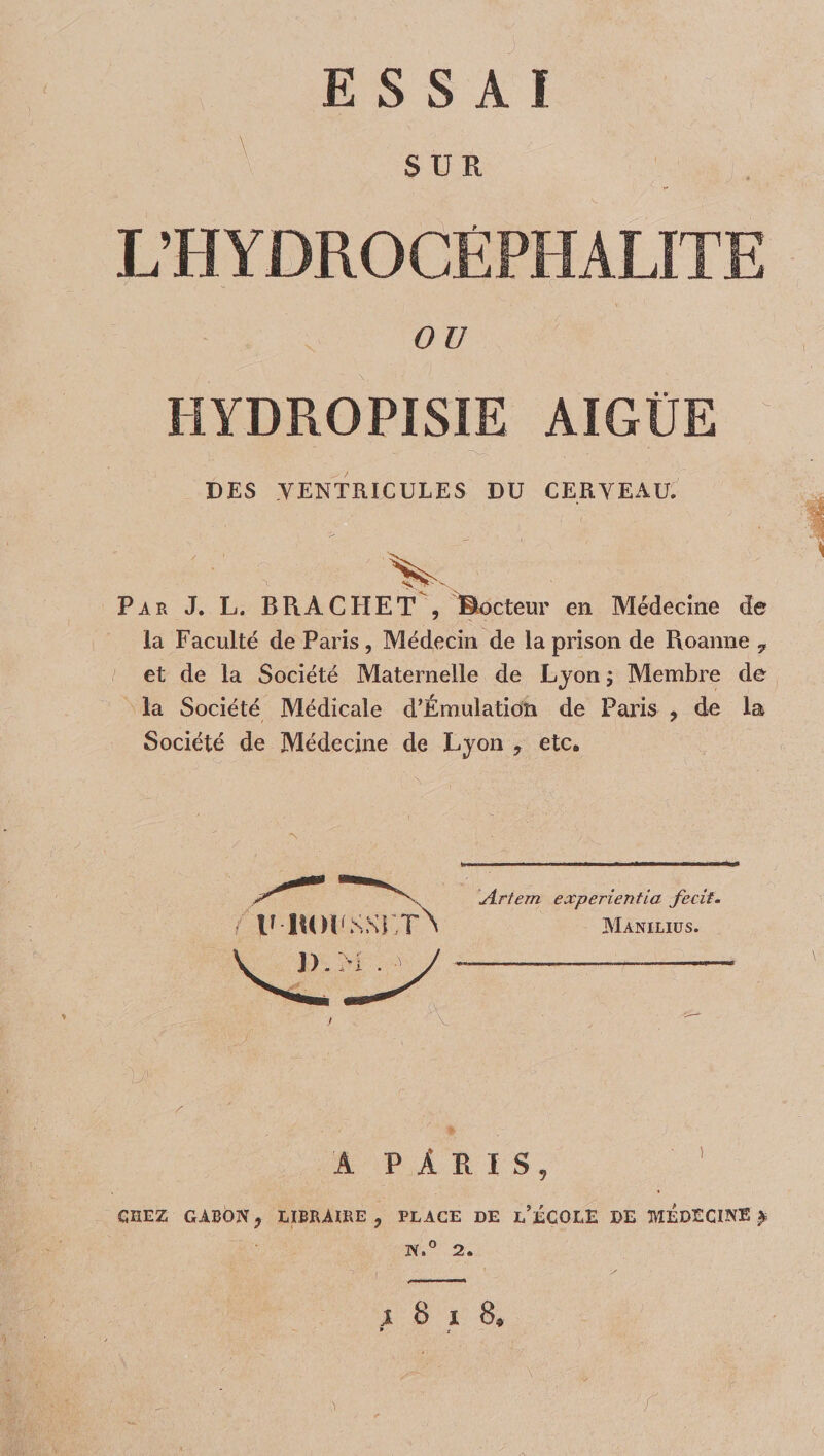 ( ESSAI SUR L’HYDROCËPHALITE ' * ' ■ . Y 1 OU IIYDROPISIE AIGÜE DES VENTRICULES DU CERVEAUX Par J. L. BRACHET , ©octeur en Médecine de la Faculté de Paris, Médecin de la prison de Roanne 7 et de la Société Maternelle de Lyon ; Membre de la Société Médicale d’Émulation de Paris , de la Société de Médecine de Lyon , etc. 1 A PARIS, ' CHEZ GABON, LIBRAIRE, PLACE DE l’ÉCOLE DE MEDECINE £ N.° 2. j8i8, ■r