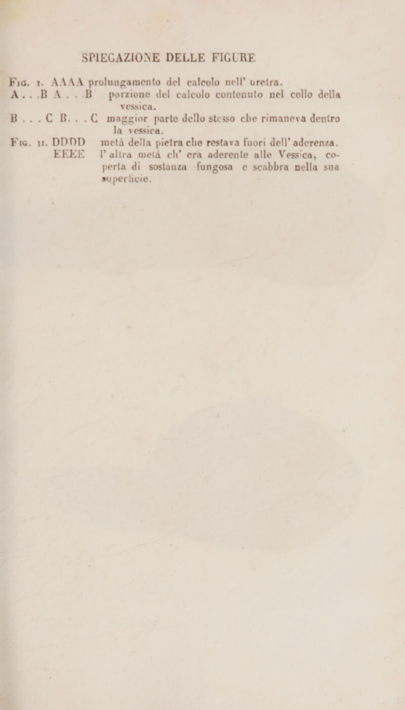 SPIEGAZIONE DELLE FIGURE Fi(J. i. AAAA prolungamento del calcolo nrlT uretra. A . . .B A . . B porzione del culcolo contenuto nel collo della vessica. B . . . C B. . . C maggior parte dello stesso che rimaneva dentro la vessica. Fio. ii. DODI) metà della pietra che restava fuori dell’aderenza. EFFE P altra mela eh* era aderente alle Vessica, co¬ perta di sostanza fungosa c scobbra nella sua superficie.