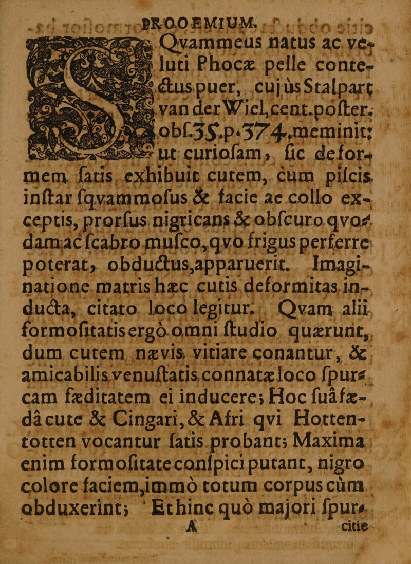 Qvammeus natus aeve* iRgrc£»rajJ| luti Phocas pelle conte« Auspuer, cujusStalparc MXgKfefe^fra van derWiel.cent.pofter. 18EB^^jM.obf.?C,p«Tr4»»mcminit curi olam» fic defor¬ mem fatis exhihuic cutem, cum pileis, inftar fqvammofus &amp; facie ae collo ex- 00,- £ poterat, obdudus,apparuerit. Imagi¬ natione matris hasc cutis deformitas in- . i • ■ :> j r. , ..y... 'V % •£ k >; J i. .’• ‘i ' £ • du&amp;a, citato loco legitur. Qvam alii formofitatisergo omni ftudio quaerunt,, dum cutem nasvis, vitiare conantur , &amp; amicabilis venuftatis connatas loco fpurtf cam faeditatem ei inducere i Hoc fuafae- da cute &amp; Cingari,&amp; Afri qvi Hotten- totten vocantur fatis probanti Maxima enim formofitatecanlpici putant, nigro colore faciem,immo totum corpus cum obduxerint* ' Et hinc quo majori fpur# A cute