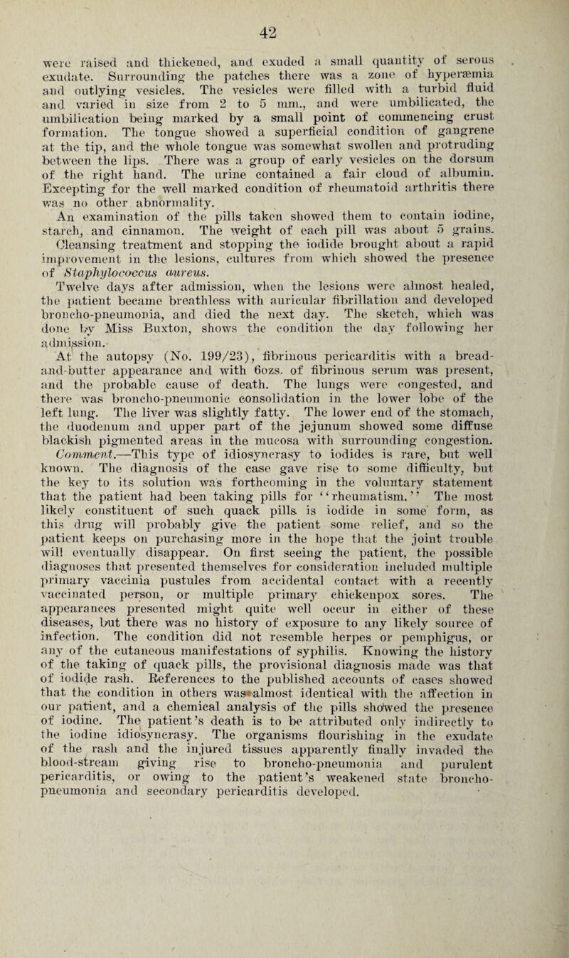 were raised and thickened, and. exuded a small quantity of serous exudate. Surrounding the patches there was a zone of liypersemia and outlying vesicles. The vesicles were tilled with a turbid fluid and varied in size from 2 to 5 mm., and were umbilicated, the umbilication being marked by a small point of commencing crust formation. The tongue showed a superficial condition of gangrene at the tip, and the whole tongue was somewhat swollen and protruding between the lips. There was a group of early vesicles on the dorsum of the right hand. The urine contained a fair cloud of albumin. Excepting for the wrell marked condition of rheumatoid arthritis there was no other abnormality. An examination of the pills taken showed them to contain iodine, starch, and cinnamon. The weight of each pill was about 5 grains. Cleansing treatment and stopping the iodide brought about a rapid improvement in the lesions, cultures from which showed the presence of Staphylococcus aureus. Twelve days after admission, when the lesions were almost healed, the patient became breathless with auricular fibrillation and developed broncho-pneumonia, and died the next day. The sketch, which was done by Miss Buxton, shows the condition the day following her admission. At the autopsy (No. 199/23), fibrinous pericarditis with a bread- and-butter appearance and with 6ozs. of fibrinous serum was present, and the probable cause of death. The lungs were congested, and there was broncho-pneumonic consolidation in the lower lobe of the left lung. The liver was slightly fatty. The lower end of the stomach, the duodenum and upper part of the jejunum showed some diffuse blackish pigmented areas in the mucosa with surrounding congestion. Comment.—This type of idiosyncrasy to iodides, is rare, but well known. The diagnosis of the case gave rise to some difficulty, but the key to its solution was forthcoming in the voluntary statement that the patient had been taking pills for ‘1 rheumatism. ’ ’ The most likely constituent of such quack pills, is iodide in some' form, as this drug will probably give the patient some relief, and so the patient keeps on purchasing more in the hope that the joint trouble will eventually disappear. On first seeing the patient, the possible diagnoses that presented themselves for consideration included multiple primary vaccinia pustules from accidental contact with a recently vaccinated person, or multiple primary chickenpox sores. The appearances presented might quite well occur in either of these diseases, but there was no history of exposure to any likely source of infection. The condition did not resemble herpes or pemphigus, or any of the cutaneous manifestations of syphilis. Knowing the history of the taking of quack pills, the provisional diagnosis made was that of iodide rash. References to the published accounts of cases showed that the condition in others was-almost identical with the affection in our patient, and a chemical analysis of the pills shoived the presence of iodine. The patient’s death is to be attributed only indirectly to the iodine idiosyncrasy. The organisms flourishing in the exudate of the rash and the injured tissues apparently finally invaded the blood-stream giving rise to broncho-pneumonia and purulent pericarditis, or owdng to the patient’s weakened state broncho¬ pneumonia and secondary pericarditis developed.