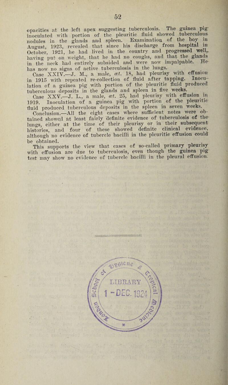 opacities at the left apex suggesting tuberculosis. The guinea pig inoculated with portion of the pleuritic fluid showed tuberculous- nodules in the glands and spleen. Examination of the boy in August, 1923, revealed that since his discharge from hospital in October, 1921, he had lived in the country and progressed well,, having put on weight, that he had no coughs, and that the glands in the neck had entirely subsided and were now impalpable. He has now no signs of active tuberculosis in the lungs. Case XXIV—J. M., a male, cet. 18, had pleurisy with effusion- in 1915 with repeated re-collection of fluid after tapping. Inocu¬ lation of a guinea pig with portion of the pleuritic fluid produced tuberculous deposits in the glands and spleen in five weeks. Case XXV.—J. L., a male, cet. 25, had pleurisy with effusion m 1919. Inoculation of a guinea pig with portion of the pleuritic fluid produced tuberculous deposits in the spleen in seven weeks. Conclusion.—All the eight cases where sufficient notes were ob¬ tained sliowe.d at least- fairly 'definite evidence of tuberculosis of the- lungs, either at the time of their pleurisy or in their subsequent histories, and four of these showed definite clinical evidence, although no evidence of tubercle bacilli in the pleuritic effusion could: be obtained. This supports the view that cases of so-called primary pleurisy with effusion are due to tuberculosis, even though the guinea pig test may show no evidence of tubercle bacilli in the pleural effusion.
