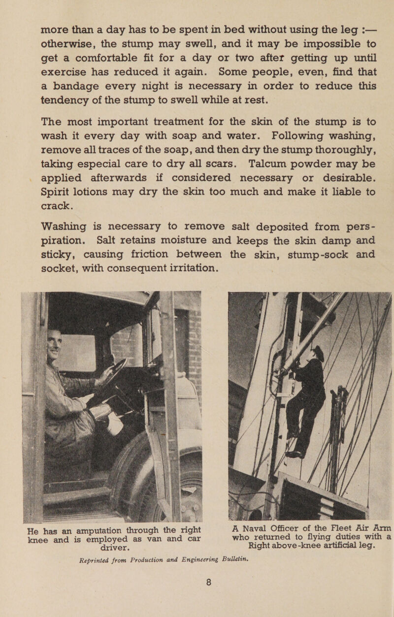 more than a day has to be spent in bed without using the leg :— otherwise, the stump may swell, and it may be impossible to get a comfortable fit for a day or two after getting up until exercise has reduced it again. Some people, even, find that a bandage every night is necessary in order to reduce this tendency of the stump to swell while at rest. The most important treatment for the skin of the stump is to wash it every day with soap and water. Following washing, remove all traces of the soap, and then dry the stump thoroughly, taking especial care to dry all scars. Talcum powder may be _ applied afterwards if considered necessary or desirable. Spirit lotions may dry the skin too much and make it liable to crack. Washing is necessary to remove salt deposited from pers- piration. Salt retains moisture and keeps the skin damp and sticky, causing friction between the skin, stump-sock and socket, with consequent irritation.  He has an amputation through the right spe ek is eh the dete Air bind i loyed as van and car who returned to flying duties wi me Maree Right above -knee artificial leg. Reprinted from Production and Engineering Bulletin.
