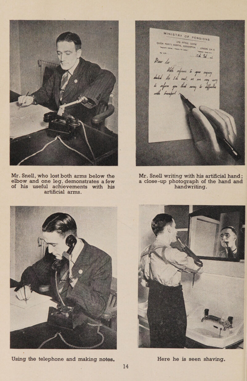  Mr. Snell, who lost both arms below the Mr. Snell writing with his artificial hand; elbow and one leg, demonstrates a few a close-up photograph of the hand and of his useful achievements with his handwriting. artificial arms. 