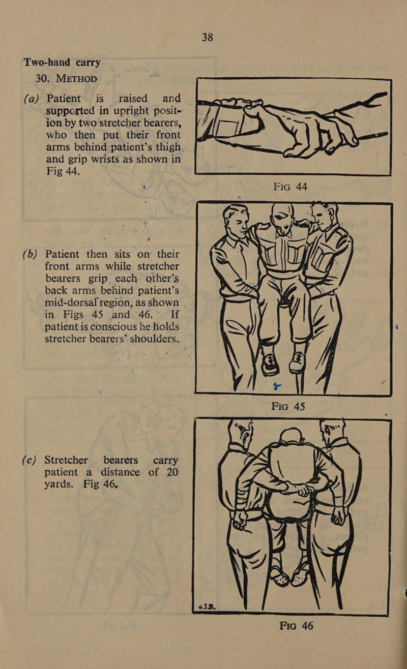 (b) (c) supported in upright posit- ion by two stretcher bearers, who then put their front arms behind patient’s thigh. and grip wrists as shown in Fig 44. Patient then sits on: their front arms while stretcher bearers grip, each other’s back arms behind patient’s mid-dorsal region, as shown | in Figs 45 and 46. If patient is conscious he Holds stretcher bearers’ shoulders.. Stretcher bearers carry patient a distance of 20 yards. Fig 46.  