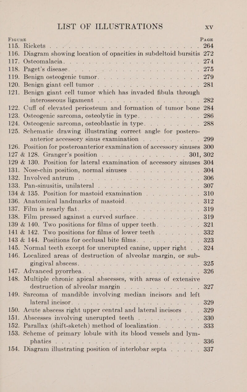 FIGURE Page 115. Rickets . ; 264 116. Diagram showing location of eeeitices in aubdeltoid Daitis 212 117. Osteomalacia. . 274 118. Paget’s disease. ~ 215 119. Benign osteogenic furnot . 279 120. Benign giant cell tumor . 281 121. Benign giant cell tumor which wae iuveded abole thrcugh interosseous ligament . ines 282 122. Cuff of elevated periosteum and formacen of ion bane 284 123. Osteogenic sarcoma, osteolytic in type. . 286 124. Osteogenic sarcoma, osteoblastic in type. 288 125. Schematic drawing illustrating correct angle for peRters: anterior accessory sinus examination . 299 126. Position for posteroanterior examination of accessory sinuses 300 127 &amp; 128. Granger’s position . . . nok Po SOT 802 129 &amp; 130. Position for lateral exanninition ar accessory sinuses 304 131. Nose-chin position, normal sinuses . . 804 1382. Involved antrum . . 3806 133. Pan-sinusitis, Sane eo ou 2307 134 &amp; 135. Position for mastoid écamninguon: ; . 310 136. Anatomical landmarks of mastoid. . 812 137. Film is nearly flat. . Bd19 138. Film pressed against a curved suniaces isa . 319 139 &amp; 140. Two positions for films of upper teeth. . 321 141 &amp; 142. Two positions for films of lower teeth . . 332 143 &amp; 144. Positions for occlusal bite films. » &lt; 328 145. Normal teeth except for unerupted canine, upper Highs . . 824 146. Localized areas of destruction of alveolar margin, or sub- : gingival abscess. . 7820 147. Advanced pyorrhea. 326 148. Multiple chronic apical ppccesses waite areas of evieeie destruction of alveolar margin . 327 149. Sarcoma of mandible involving median 4 incisors al left lateral incisor. ane 2529 150. Acute abscess right upper picoutnalt aad Tagerar incisors |. . 329 151. Abscesses involving unerupted teeth . . 330 152. Parallax (shift-sketch) method of jocaltzationk 333 153. Scheme of primary lobule with its blood vessels and ae phatics . nee . 336 154. Diagram Higetrating chon a niente bar oe . 337