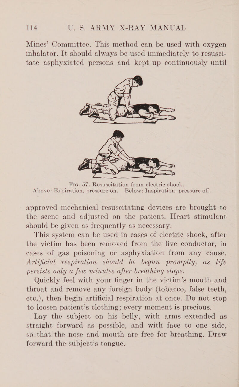 Mines’ Committee. This method can be used with oxygen inhalator. It should always be used immediately to resusci- tate asphyxiated persons and kept up continuously until  Fic. 57. Resuscitation from electric shock. Above: Expiration, pressure on. Below: Inspiration, pressure off. approved mechanical resuscitating devices are brought to the scene and adjusted on the patient. Heart stimulant should be given as frequently as necessary. This system can be used in cases of electric shock, after the victim has been removed from the live conductor, in cases of gas poisoning or asphyxiation from any cause. Artificial respiration should be begun promptly, as life persists only a few minutes after breathing stops. Quickly feel with your finger in the victim’s mouth and throat and remove any foreign body (tobacco, false teeth, ete.), then begin artificial respiration at once. Do not stop to loosen patient’s clothing; every moment is precious. Lay the subject on his belly, with arms extended as straight forward as possible, and with face to one side, so that the nose and mouth are free for breathing. Draw forward the subject’s tongue.