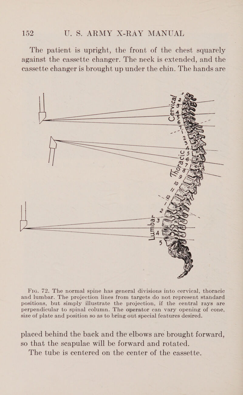 The patient is upright, the front of the chest squarely against the cassette changer. The neck is extended, and the cassette changer is brought up under the chin. The hands are  Fig. 72. The normal spine has general divisions into cervical, thoracic and lumbar. The projection lines from targets do not represent standard positions, but simply illustrate the projection, if the central rays are perpendicular to spinal column. The operator can vary opening of cone, size of plate and position so as to bring out special features desired. placed behind the back and the elbows are brought forward, so that the scapulae will be forward and rotated. The tube is centered on the center of the cassette.