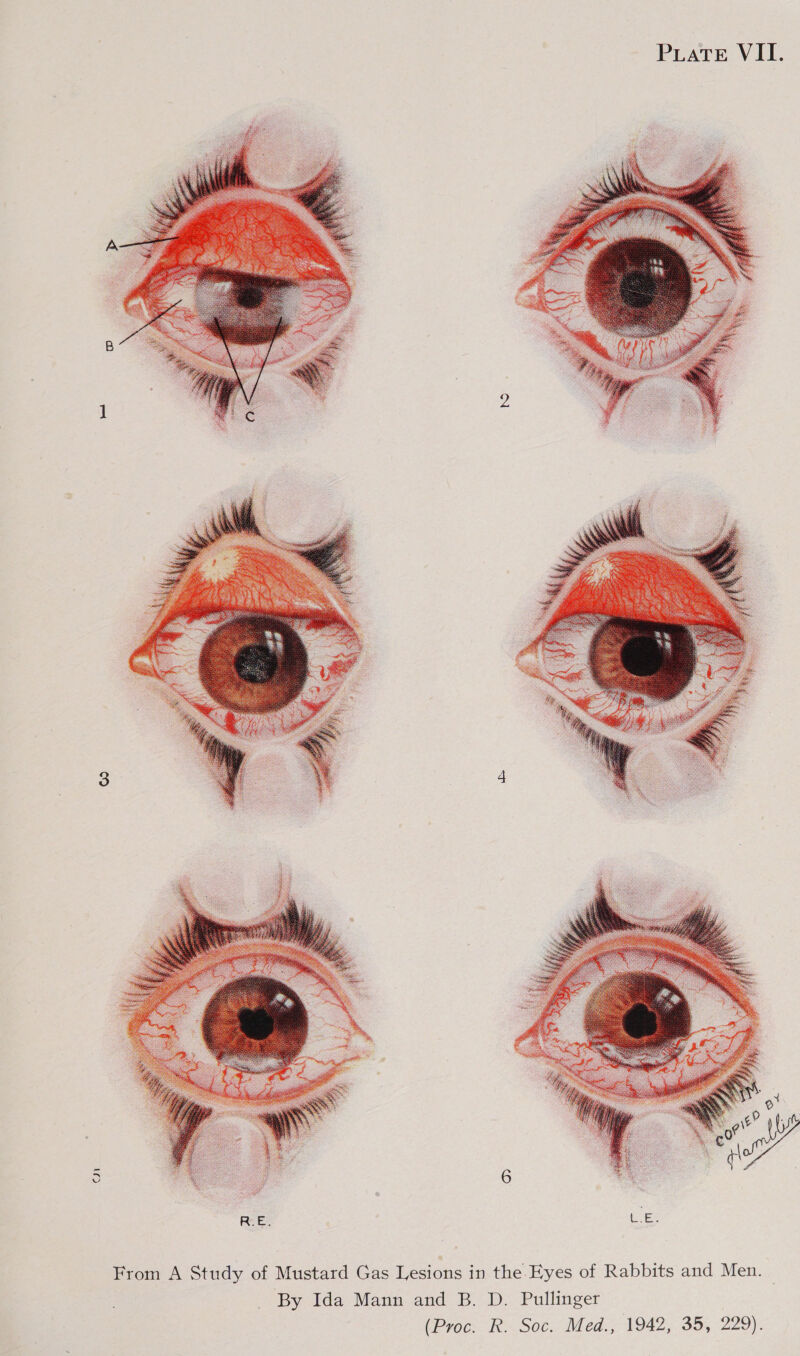  ON  From A Study of Mustard Gas Lesions in the Eyes of Rabbits and Men. By Ida Mann and B.D. Pullinger (Proc. R. Soc. Med., 1942, 35, 229).