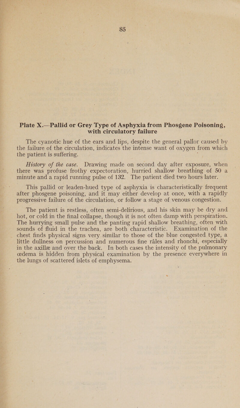 85 Plate X.—Pallid or Grey Type of Asphyxia from Phosgene Pe with circulatory failure The cyanotic hue of the ears and lips, despite the general pallor caused by the failure of the circulation, indicates the intense want of oxygen from which the patient is suffering. History of the case. Drawing made on second day after exposure, when there was profuse frothy expectoration, hurried shallow breathing of 50 a minute and a rapid running pulse of 132. The patient died two hours later. This pallid or leaden-hued type of asphyxia is characteristically frequent after phosgene poisoning, and it may either develop at once, with a rapidly progressive failure of the circulation, or follow a stage of venous congestion. The patient is restless, often semi-delirious, and his skin may be dry and hot, or cold in the final collapse, though it is not often damp with perspiration. The hurrying small pulse and the panting rapid shallow breathing, often with sounds of fluid in the trachea, are both characteristic. Examination of the _ chest finds physical signs very similar to those of the blue congested type, a little dullness on percussion and numerous fine rales and rhonchi, especially in the axillz and over the back. In both cases the intensity of the pulmonary cedema is hidden from physical examination by the presence everywhere in the lungs of scattered islets of emphysema.
