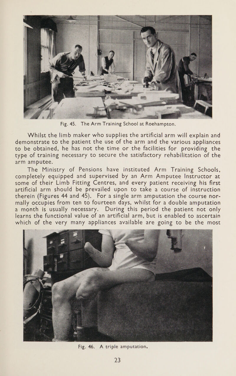  Whilst the limb maker who supplies the artificial arm will explain and demonstrate to the patient the use of the arm and the various appliances to be obtained, he has not the time or the facilities for providing the type of training necessary to secure the satisfactory rehabilitation of the arm amputee. The Ministry of Pensions have instituted Arm Training Schools, completely equipped and supervised by an Arm Amputee Instructor at some of their Limb Fitting Centres, and every patient receiving his first artificial arm should be prevailed upon to take a course of instruction therein (Figures 44 and 45). For a single arm amputation the course nor- mally occupies from ten to fourteen days, whilst for a double amputation a month is usually necessary. During this period the patient not only learns the functional value of an artificial arm, but is enabled to ascertain which of the very many appliances available are going to be the most  Fig. 46. A triple amputation,
