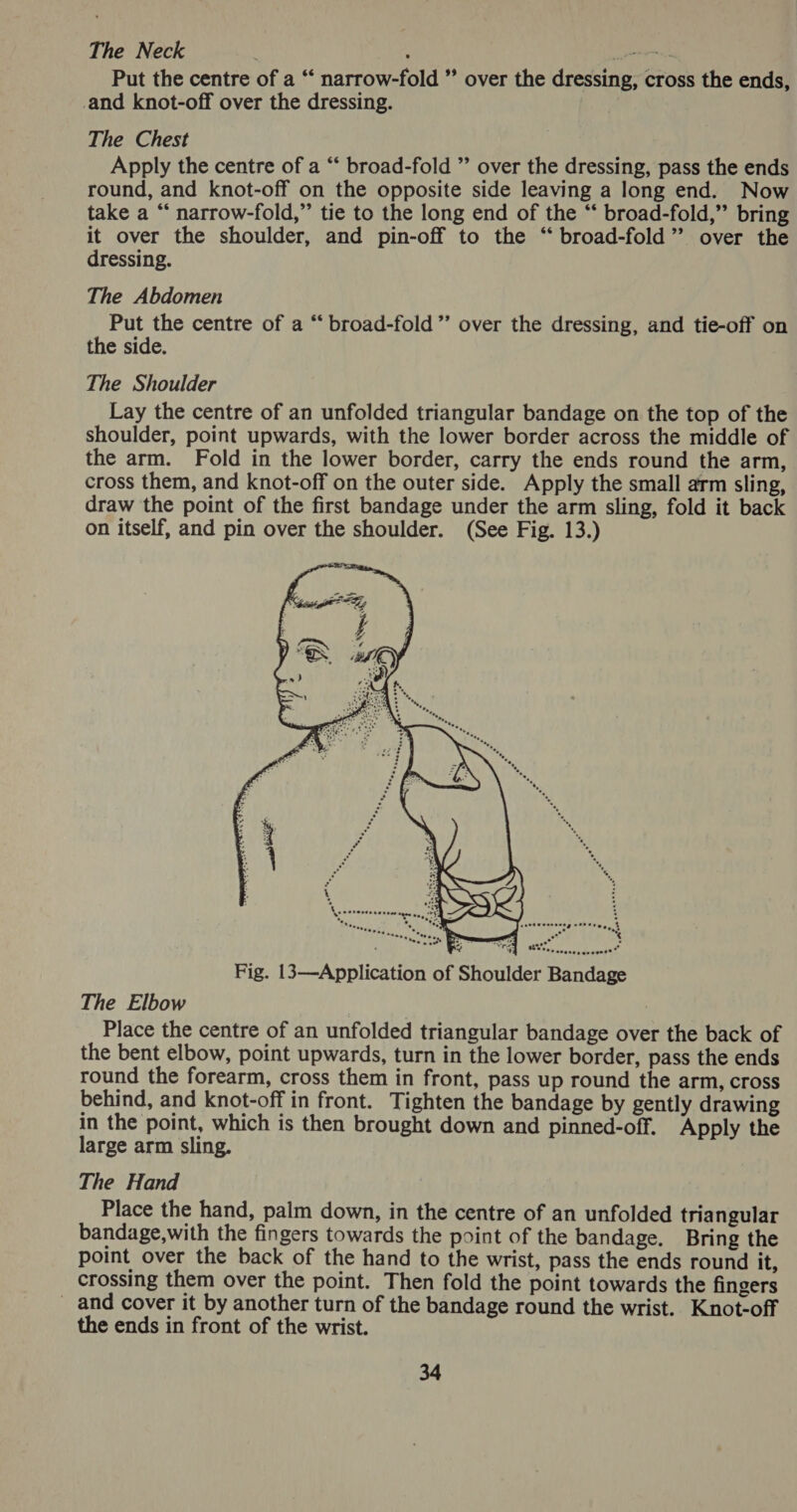 The Neck [ee Put the centre of a “ narrow-fold ” over the dressing, cross the ends, and knot-off over the dressing. The Chest Apply the centre of a “ broad-fold ” over the dressing, pass the ends round, and knot-off on the opposite side leaving a long end. Now take a “ narrow-fold,” tie to the long end of the “ broad-fold,” bring it over the shoulder, and pin-off to the “ broad-fold”’ over the dressing. The Abdomen Put the centre of a “‘ broad-fold ” over the dressing, and tie-off on the side. The Shoulder Lay the centre of an unfolded triangular bandage on the top of the shoulder, point upwards, with the lower border across the middle of the arm. Fold in the lower border, carry the ends round the arm, cross them, and knot-off on the outer side. Apply the small arm sling, draw the point of the first bandage under the arm sling, fold it back on itself, and pin over the shoulder. (See Fig. 13.)  The Elbow Place the centre of an unfolded triangular bandage over the back of the bent elbow, point upwards, turn in the lower border, pass the ends round the forearm, cross them in front, pass up round the arm, cross behind, and knot-off in front. Tighten the bandage by gently drawing in the point, which is then brought down and pinned-off. Apply the large arm sling. The Hand Place the hand, palm down, in the centre of an unfolded triangular bandage,with the fingers towards the point of the bandage. Bring the point over the back of the hand to the wrist, pass the ends round it, crossing them over the point. Then fold the point towards the fingers _ and cover it by another turn of the bandage round the wrist. Knot-off the ends in front of the wrist.