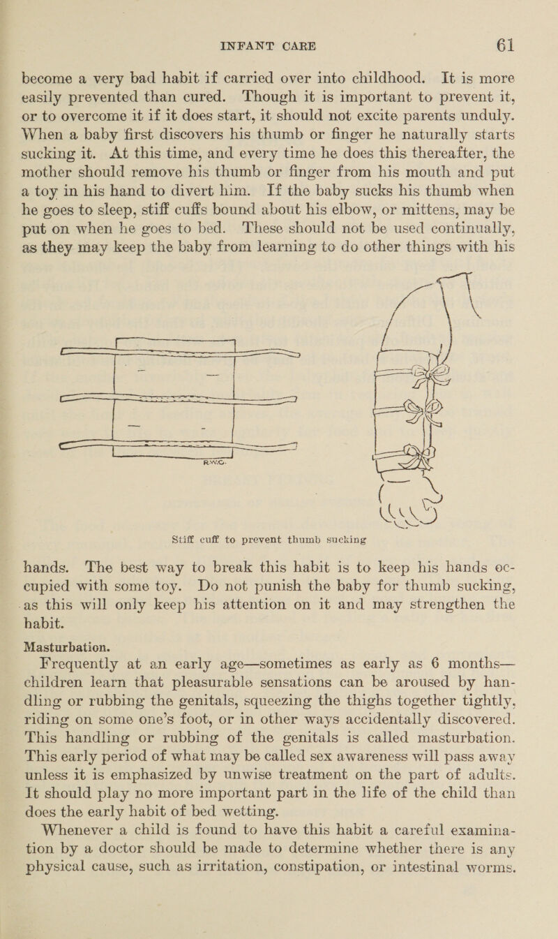 become a very bad habit if carried over into childhood. It is more easily prevented than cured. Though it is important to prevent. it, or to overcome it if it does start, it should not excite parents unduly. When a baby first discovers his thumb or finger he naturally starts sucking it. At this time, and every time he does this thereafter, the mother should remove his thumb or finger from his mouth and put a toy in his hand to divert him. If the baby sucks his thumb when he goes to sleep, stiff cuffs bound about his elbow, or mittens, may be put on when he goes to bed. These should not be used continually, as they may keep the baby from learning to do other things with his  Stiff cuff to prevent thumb sucking hands. The best way to break this habit is to keep his hands oc- eupied with some toy. Do not punish the baby for thumb sucking, -as this will only keep his attention on it and may strengthen the habit. Masturbation. Frequently at an early age—sometimes as early as 6 months— children learn that pleasurable sensations can be aroused by han- dling or rubbing the genitals, squeezing the thighs together tightly, riding on some one’s foot, or in other ways accidentally discovered. This handling or rubbing of the genitals is called masturbation. This early period of what may be called sex awareness will pass away unless it is emphasized by unwise treatment on the part of adulis. It should play no more important part in the life of the child than does the early habit of bed wetting. ~ Whenever a child is found to have this habit a careful examina- tion by a doctor should be made to determine whether there is any physical cause, such as irritation, constipation, or intestinal worms.