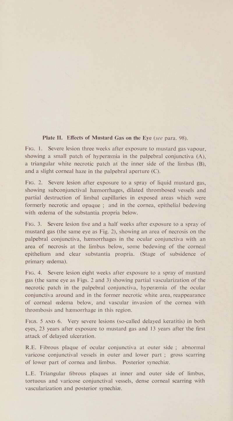 Fic. 1. Severe lesion three weeks after exposure to mustard gas vapour, showing a small patch of hyperemia in the palpebral conjunctiva (A), a triangular white necrotic patch at the inner side of the limbus (B), and a slight corneal haze in the palpebral aperture (C). Fic. 2. Severe lesion after exposure to a spray of liquid mustard gas, showing subconjunctival hemorrhages, dilated thrombosed vessels and partial destruction of limbal capillaries in exposed areas which were formerly necrotic and opaque ; and in the cornea, epithelial bedewing with cedema of the substantia propria below. Fic. 3. Severe lesion five and a half weeks after exposure to a spray of mustard gas (the same eye as Fig. 2), showing an area of necrosis on the palpebral conjunctiva, hemorrhages in the ocular conjunctiva with an area of necrosis at the limbus below, some bedewing of the corneal epithelium and clear substantia propria. (Stage of subsidence of primary oedema). Fic. 4. Severe lesion eight weeks after exposure to a spray of mustard gas (the same eye as Figs. 2 and 3) showing partial vascularization of the necrotic patch in the palpebral conjunctiva, hyperemia of the ocular conjunctiva around and in the former necrotic white area, reappearance of corneal cedema below, and vascular invasion of the cornea with thrombosis and hemorrhage in this region. Fics. 5 AND 6. Very severe lesions (so-called delayed keratitis) in both eyes, 23 years after exposure to mustard gas and 13 years after ‘the first attack of delayed ulceration. R.E. Fibrous plaque of ocular conjunctiva at outer side ; abnormal varicose conjunctival vessels in outer and lower part ; gross scarring of lower part of cornea and limbus. Posterior synechiz. L.E. Triangular fibrous plaques at inner and outer side of limbus, tortuous and varicose conjunctival vessels, dense corneal scarring with vascularization and posterior synechie.
