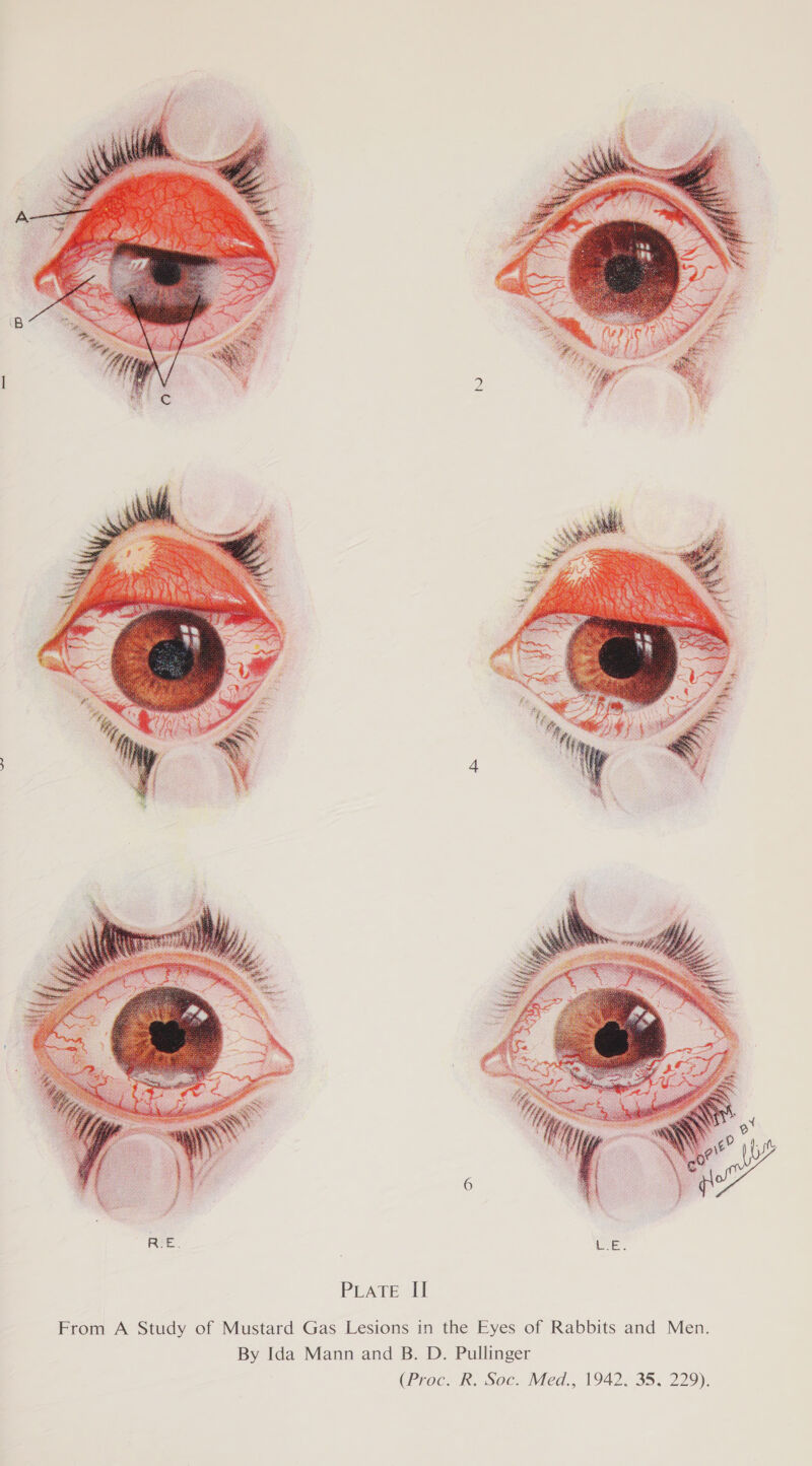  From A Study of Mustard Gas Lesions in the Eyes of Rabbits and Men. By Ida Mann and B. D. Pullinger (Proce. Soce Ved... 1942. 35, 229).