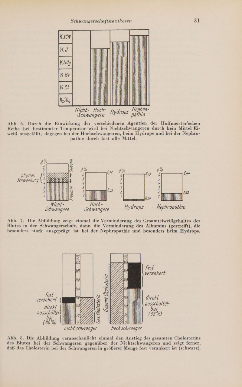 Kö INNIAHNN IK I Nich£&amp;- Hoch- ; Nephro- Schwangere Aydrops pathie Abb. 6. Durch die Einwirkung der verschiedenen Agentien der Hoffmeister’schen Reihe bei bestimmter Temperatur wird bei Nichtschwangeren durch kein Mittel Ei- weiß ausgefällt, dagegen bei der Hochschwangeren, beim Hydrops und bei der Nephro- pathie durch fast alle Mittel.      &gt; —      9% S : Ss 7% 9% 9% . x : = 6 (7) ohysiol. SEVZZZZZZAN | “ a: 64 Schwankung , KERN . 2 5 i | er a Z 162 Z 7 Bol D / NichF- Hoch- Schwangere Schwangere Hvdrops . Nephropathie Abb. 7. Die Abbildung zeigt einmal die Verminderung des Gesamteiweißgehaltes des Blutes in der Schwangerschaft, dann die Verminderung des Albumins (gestreift), die besonders stark ausgeprägt ist bei der Nephropathie und besonders beim Hydrops. fest veranker£  Gesamt Cholesterin fes z SQ . veranker£ { S direkl, = ausschuttel- direk£ = bar ausschüttel. S (59%) ar g (80%) o () nichE schwanger hoch Schwanger Abb. 8. Die Abbildung veranschaulicht einmal den Anstieg des gesamten Cholesterins des Blutes bei der Schwangeren gegenüber der Nichtschwangeren und zeigt ferner, daß das Cholesterin bei der Schwangeren in größerer Menge fest verankert ist (schwarz).