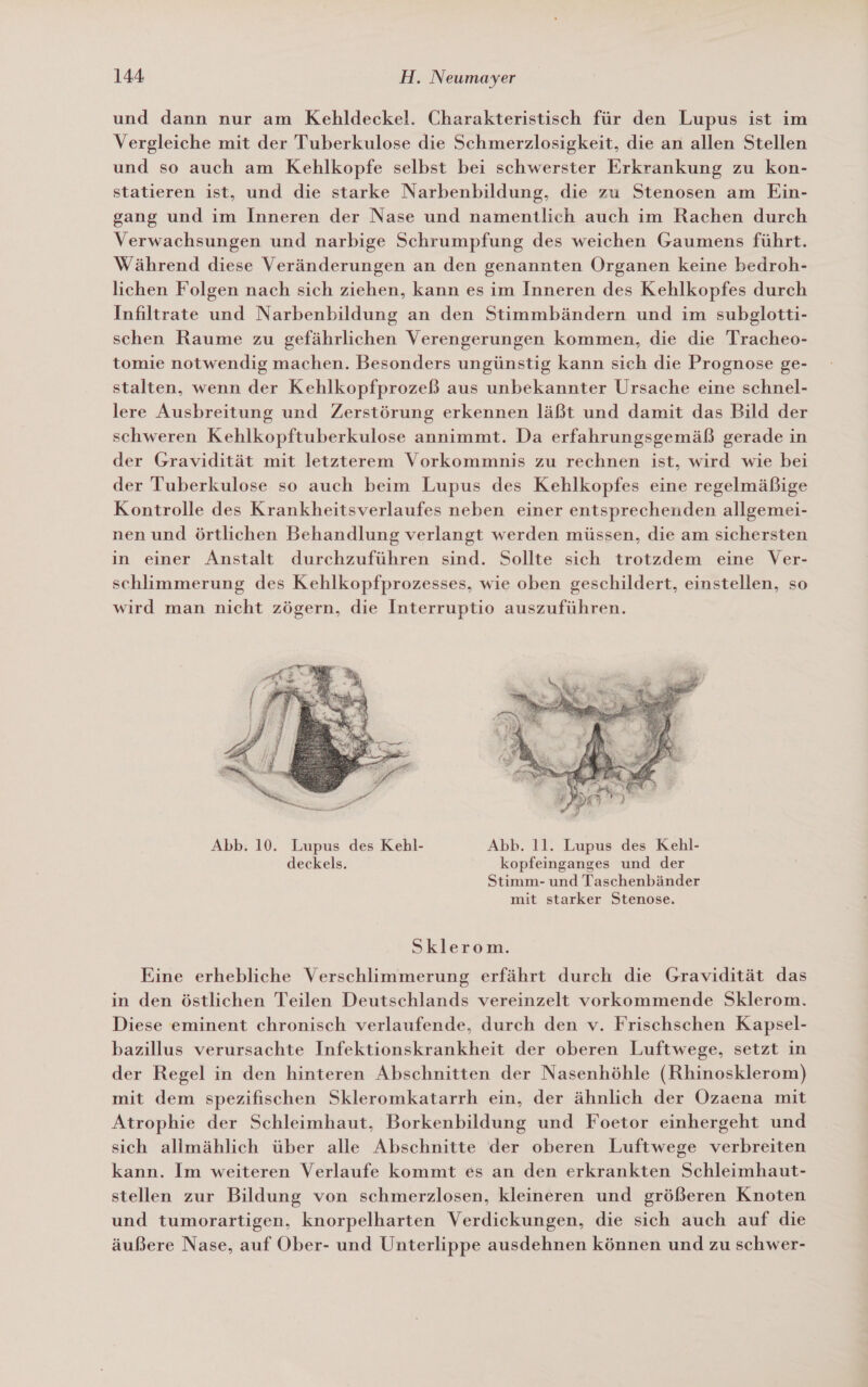 und dann nur am Kehldeckel. Charakteristisch für den Lupus ist im Vergleiche mit der Tuberkulose die Schmerzlosigkeit, die an allen Stellen und so auch am Kehlkopfe selbst bei schwerster Erkrankung zu kon- statieren ist, und die starke Narbenbildung, die zu Stenosen am Ein- gang und im Inneren der Nase und namentlich auch im Rachen durch Verwachsungen und narbige Schrumpfung des weichen Gaumens führt. Während diese Veränderungen an den genannten Organen keine bedroh- lichen Folgen nach sich ziehen, kann es im Inneren des Kehlkopfes durch Infiltrate und Narbenbildung an den Stimmbändern und im subglotti- schen Raume zu gefährlichen Verengerungen kommen, die die Tracheo- tomie notwendig machen. Besonders ungünstig kann sich die Prognose ge- stalten, wenn der Kehlkopfprozeß aus unbekannter Ursache eine schnel- lere Ausbreitung und Zerstörung erkennen läßt und damit das Bild der schweren Kehlkopftuberkulose annimmt. Da erfahrungsgemäß gerade in der Gravidität mit letzterem Vorkommnis zu rechnen ist, wird wie bei der Tuberkulose so auch beim Lupus des Kehlkopfes eine regelmäßige Kontrolle des Krankheitsverlaufes neben einer entsprechenden allgemei- nen und örtlichen Behandlung verlangt werden müssen, die am sichersten in einer Anstalt durchzuführen sind. Sollte sich trotzdem eine Ver- schlimmerung des Kehlkopfprozesses, wie oben geschildert, einstellen, so wird man nicht zögern, die Interruptio auszuführen.  Abb. 10. Lupus des Kehl- Abb. 11. Lupus des Kehl- deckels. kopfeinganges und der Stimm- und Taschenbänder mit starker Stenose. Sklerom. Eine erhebliche Verschlimmerung erfährt durch die Gravidität das in den östlichen Teilen Deutschlands vereinzelt vorkommende Sklerom. Diese eminent chronisch verlaufende, durch den v. Frischschen Kapsel- bazillus verursachte Infektionskrankheit der oberen Luftwege, setzt in der Regel in den hinteren Abschnitten der Nasenhöhle (Rhinosklerom) mit dem spezifischen Skleromkatarrh ein, der ähnlich der Ozaena mit Atrophie der Schleimhaut, Borkenbildung und Foetor einhergeht und sich allmählich über alle Abschnitte der oberen Luftwege verbreiten kann. Im weiteren Verlaufe kommt es an den erkrankten Schleimhaut- stellen zur Bildung von schmerzlosen, kleineren und größeren Knoten und tumorartigen, knorpelharten Verdickungen, die sich auch auf die äußere Nase, auf Ober- und Unterlippe ausdehnen können und zu schwer-