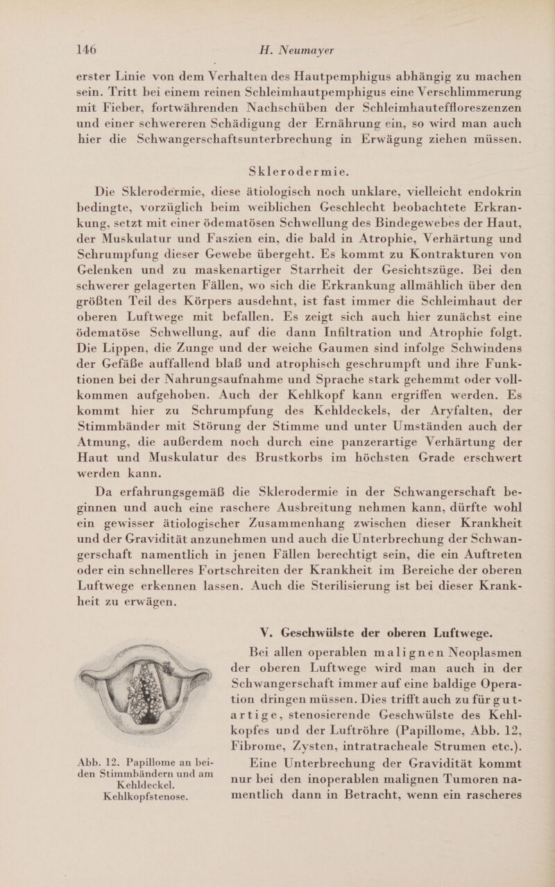 erster Linie von dem Verhalten des Hautpemphigus abhängig zu machen sein. Tritt bei einem reinen Schleimhautpemphigus eine Verschlimmerung mit Fieber, fortwährenden Nachschüben der Schleimhauteffloreszenzen und einer schwereren Schädigung der Ernährung ein, so wird man auch hier die Schwangerschaftsunterbrechung in Erwägung ziehen müssen. Sklerodermie. Die Sklerodermie, diese ätiologisch noch unklare, vielleicht endokrin bedingte, vorzüglich beim weiblichen Geschlecht beobachtete Erkran- kung, setzt mit einer ödematösen Schwellung des Bindegewebes der Haut, der Muskulatur und Faszien ein, die bald in Atrophie, Verhärtung und Schrumpfung dieser Gewebe übergeht. Es kommt zu Kontrakturen von Gelenken und zu maskenartiger Starrheit der Gesichtszüge. Bei den schwerer gelagerten Fällen, wo sich die Erkrankung allmählich über den größten Teil des Körpers ausdehnt, ist fast immer die Schleimhaut der oberen Luftwege mit befallen. Es zeigt sich auch hier zunächst eine ödematöse Schwellung, auf die dann Infiltration und Atrophie folgt. Die Lippen, die Zunge und der weiche Gaumen sind infolge Schwindens der Gefäße auffallend blaß und atrophisch geschrumpft und ihre Funk- tionen bei der Nahrungsaufnahme und Sprache stark gehemmt oder voll- kommen aufgehoben. Auch der Kehlkopf kann ergriffen werden. Es kommt hier zu Schrumpfung des Kehldeckels, der Aryfalten, der Stimmbänder mit Störung der Stimme und unter Umständen auch der Atmung, die außerdem noch durch eine panzerartige Verhärtung der Haut und Muskulatur des Brustkorbs im höchsten Grade erschwert werden kann. Da erfahrungsgemäß die Sklerodermie in der Schwangerschaft be- ginnen und auch eine raschere Ausbreitung nehmen kann, dürfte wohl ein gewisser ätiologischer Zusammenhang zwischen dieser Krankheit und der Gravidität anzunehmen und auch die Unterbrechung der Schwan- gerschaft namentlich in jenen Fällen berechtigt sein, die ein Auftreten oder ein schnelleres Fortschreiten der Krankheit im Bereiche der oberen Luftwege erkennen lassen. Auch die Sterilisierung ist bei dieser Krank- heit zu erwägen. V. Geschwülste der oberen Luftwege. Bei allen operablen malignen Neoplasmen der oberen Luftwege wird man auch in der Schwangerschaft immer auf eine baldige Opera- tion dringen müssen. Dies trifft auch zu für gut- artige, stenosierende Geschwülste des Kehl- kopfes und der Luftröhre (Papillome, Abb. 12, Fibrome, Zysten, intratracheale Strumen etc.).  Abb. 12. Papillome an bei- Eine Unterbrechung der Gravidität kommt —_ ae undam nur bei den inoperablen malignen Tumoren na- Kehlkopfstenose. mentlich dann in Betracht, wenn ein rascheres