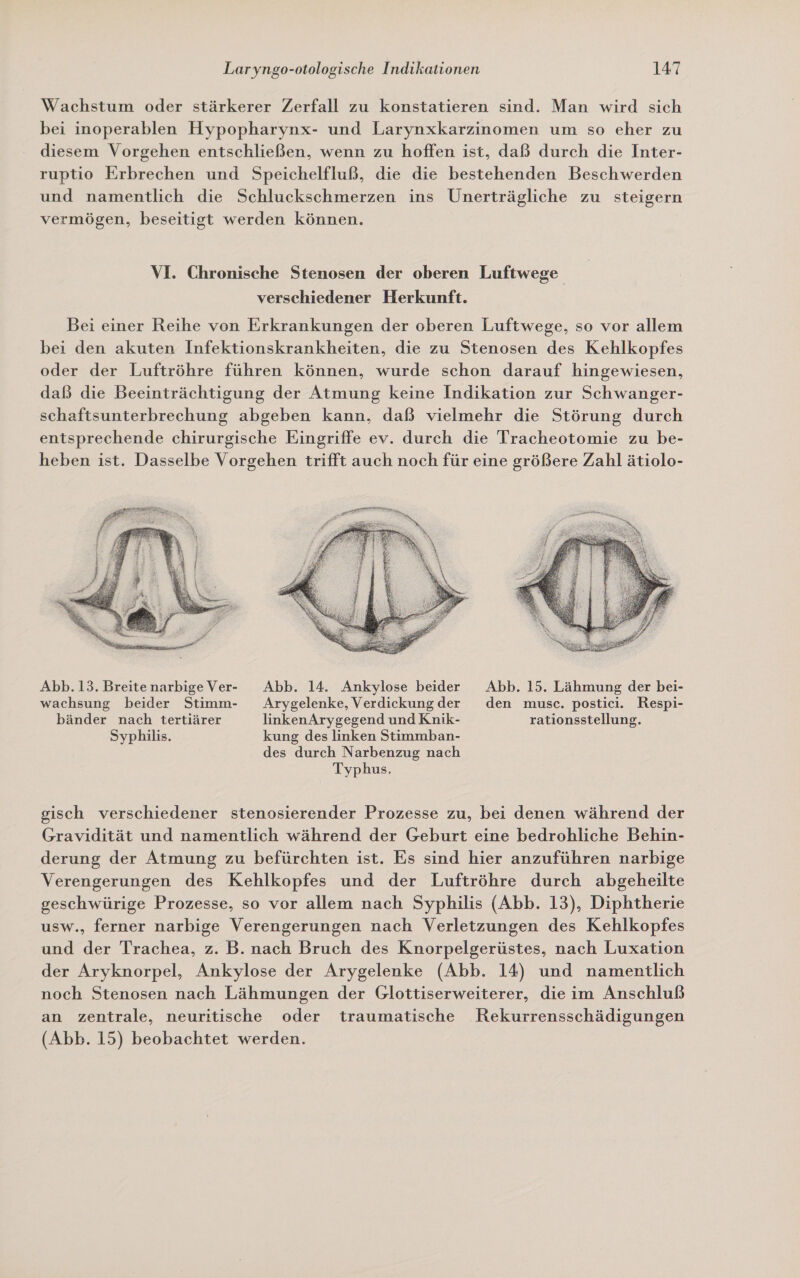 Wachstum oder stärkerer Zerfall zu konstatieren sind. Man wird sich bei inoperablen Hypopharynx- und Larynxkarzinomen um so eher zu diesem Vorgehen entschließen, wenn zu hoffen ist, daß durch die Inter- ruptio Erbrechen und Speichelfluß, die die bestehenden Beschwerden und namentlich die Schluckschmerzen ins Unerträgliche zu steigern vermögen, beseitigt werden können. VI. Chronische Stenosen der oberen Luftwege verschiedener Herkunft. Bei einer Reihe von Erkrankungen der oberen Luftwege, so vor allem bei den akuten Infektionskrankheiten, die zu Stenosen des Kehlkopfes oder der Luftröhre führen können, wurde schon darauf hingewiesen, daß die Beeinträchtigung der Atmung keine Indikation zur Schwanger- schaftsunterbrechung abgeben kann, daß vielmehr die Störung durch entsprechende chirurgische Eingriffe ev. durch die Tracheotomie zu be- heben ist. Dasselbe Vorgehen trifft auch noch für eine größere Zahl ätiolo-  Abb.13.BreitenarbigeVer-- Abb. 14. Ankylose beider Abb. 15. Lähmung der bei- wachsung beider Stimm- Arygelenke, Verdickungder den musc. postici. Respi- bänder nach tertiärer linkenArygegend und Knik- rationsstellung. Syphilis. kung des linken Stimmban- des durch Narbenzug nach Typhus. gisch verschiedener stenosierender Prozesse zu, bei denen während der Gravidität und namentlich während der Geburt eine bedrohliche Behin- derung der Atmung zu befürchten ist. Es sind hier anzuführen narbige Verengerungen des Kehlkopfes und der Luftröhre durch abgeheilte geschwürige Prozesse, so vor allem nach Syphilis (Abb. 13), Diphtherie usw., ferner narbige Verengerungen nach Verletzungen des Kehlkopfes und der Trachea, z. B. nach Bruch des Knorpelgerüstes, nach Luxation der Aryknorpel, Ankylose der Arygelenke (Abb. 14) und namentlich noch Stenosen nach Lähmungen der Glottiserweiterer, dieim Anschluß an zentrale, neuritische oder traumatische Rekurrensschädigungen (Abb. 15) beobachtet werden.