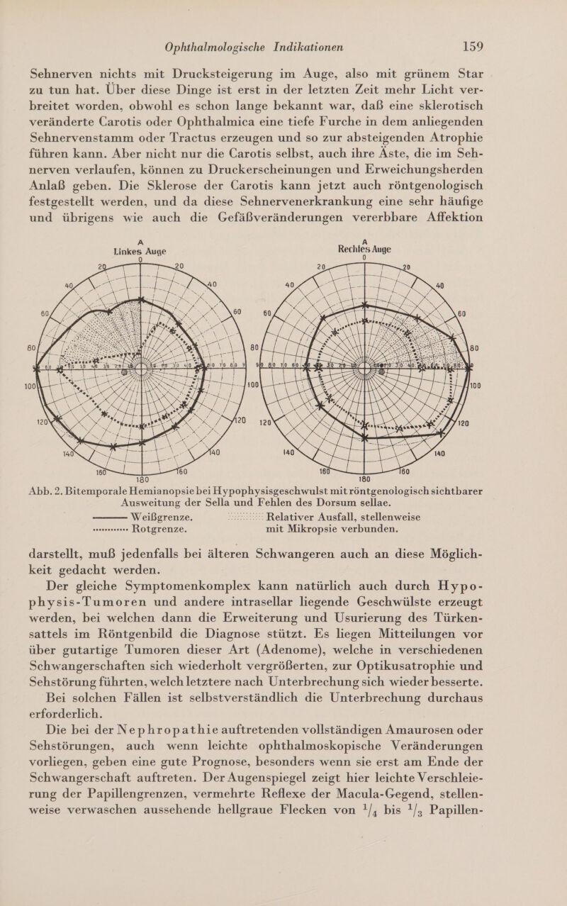 Sehnerven nichts mit Drucksteigerung im Auge, also mit grünem Star zu tun hat. Über diese Dinge ist erst in der letzten Zeit mehr Licht ver- breitet worden, obwohl es schon lange bekannt war, daß eine sklerotisch veränderte Carotis oder Ophthalmica eine tiefe Furche in dem anliegenden Sehnervenstamm oder Tractus erzeugen und so zur absteigenden Atrophie führen kann. Aber nicht nur die Carotis selbst, auch ihre Äste, die im Seh- nerven verlaufen, können zu Druckerscheinungen und Erweichungsherden Anlaß geben. Die Sklerose der Carotis kann jetzt auch röntgenologisch festgestellt werden, und da diese Sehnervenerkrankung eine sehr häufige und übrigens wie auch die Gefäßveränderungen vererbbare Affektion A A Linkes Auge Bemnies Auge f)  = Im \% | A E Abb. 2. Bitemporale Hemianopsie bei Hypophysisgeschwulst mit röntgenologisch sichtbarer Ausweitung der Sella und Fehlen des Dorsum sellae. Weißgrenze. 22:2 Relativer Ausfall, stellenweise anunernernen Rotgrenze. mit Mikropsie verbunden.  darstellt, muß jedenfalls bei älteren Schwangeren auch an diese Möglich- keit gedacht werden. Der gleiche Symptomenkomplex kann natürlich auch durch Hypo- physis-Tumoren und andere intrasellar liegende Geschwülste erzeugt werden, bei welchen dann die Erweiterung und Usurierung des Türken- sattels im Röntgenbild die Diagnose stützt. Es liegen Mitteilungen vor über gutartige Tumoren dieser Art (Adenome), welche in verschiedenen Schwangerschaften sich wiederholt vergrößerten, zur Optikusatrophie und Sehstörung führten, welch letztere nach Unterbrechung sich wieder besserte. Bei solchen Fällen ist selbstverständlich die Unterbrechung durchaus erforderlich. Die bei der Nephropathie auftretenden vollständigen Amaurosen oder Sehstörungen, auch wenn leichte ophthalmoskopische Veränderungen vorliegen, geben eine gute Prognose, besonders wenn sie erst am Ende der Schwangerschaft auftreten. Der Augenspiegel zeigt hier leichte Verschleie- rung der Papillengrenzen, vermehrte Reflexe der Macula-Gegend, stellen- weise verwaschen aussehende hellgraue Flecken von !/, bis !/, Papillen-