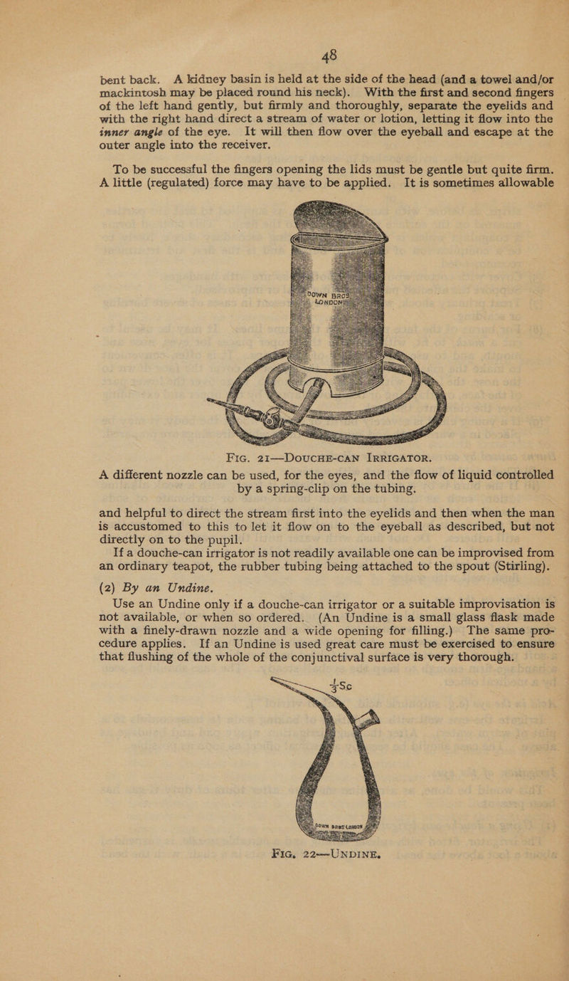 bent back. A kidney basin is held at the side of the head (and a towel and/or mackintosh may be placed round his neck). With the first and second fingers _ of the left hand gently, but firmly and thoroughly, separate the eyelids and with the right hand direct a stream of water or lotion, letting it flow into the inner angle of the eye. It will then flow over the eyeball and escape at the outer angle into the receiver. To be successful the fingers opening the lids must be gentle but quite firm. A little (regulated) force may have to be applied. It is sometimes allowable     iim — te   STH          Fic. 21—DoucHE-CAN IRRIGATOR. A different nozzle can be used, for the eyes, and the flow of liquid controlled by a spring-clip on the tubing. and helpful to direct the stream first into the eyelids and then when the man is accustomed to this to let it flow on to the eyeball as described, but not directly on to the pupil. If a douche-can irrigator is not readily available one can be improvised from an ordinary teapot, the rubber tubing being attached to the spout (Stirling). (2) By an Undine. Use an Undine only if a douche-can irrigator or a suitable improvisation is not available, or when so ordered. (An Undine is a small glass flask made with a finely-drawn nozzle and a wide opening for filling.) The same pro- cedure applies. If an Undine is used great care must be exercised to ensure that flushing of the whole of the conjunctival surface is very thorough.  : Bees See Fic, 22—~UNDINE.