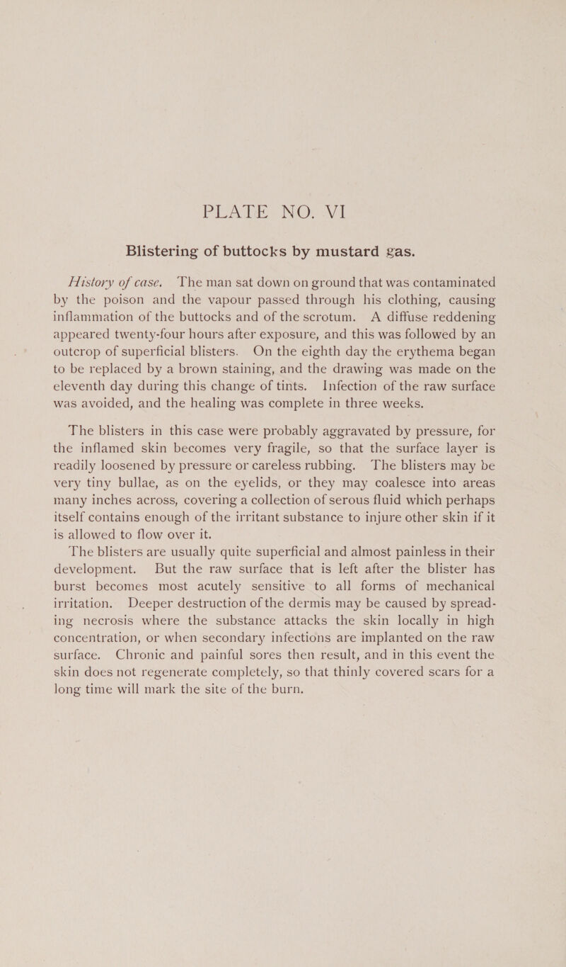 PLATE NOrc Ar Blistering of buttocks by mustard gas. History of case. ‘The man sat down on ground that was contaminated by the poison and the vapour passed through his clothing, causing inflammation of the buttocks and of the scrotum. A diffuse reddening appeared twenty-four hours after exposure, and this was followed by an outcrop of superficial blisters. On the eighth day the erythema began to be replaced by a brown staining, and the drawing was made on the eleventh day during this change of tints. Infection of the raw surface was avoided, and the healing was complete in three weeks. The blisters in this case were probably aggravated by pressure, for the inflamed skin becomes very fragile, so that the surface layer is readily loosened by pressure or careless rubbing. ‘The blisters may be very tiny bullae, as on the eyelids, or they may coalesce into areas nany inches across, covering a collection of serous fluid which perhaps itself contains enough of the irritant substance to injure other skin if it is allowed to flow over it. The blisters are usually quite superficial and almost painless in their development. But the raw surface that is left after the blister has burst becomes most acutely sensitive to all forms of mechanical irritation. Deeper destruction of the dermis may be caused by spread- ing necrosis where the substance attacks the skin locally in high concentration, or when secondary infections are implanted on the raw surface. Chronic and painful sores then result, and in this event the skin does not regenerate completely, so that thinly covered scars for a long time will mark the site of the burn.