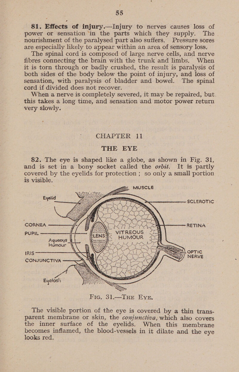 81. Effects of injury.—Injury to nerves causes loss of power or sensation ‘in the parts which they supply. The nourishment of the paralysed part also suffers. Pressure sores are especially likely to appear within an area of sensory loss. The spinal cord is composed of large nerve cells, and nerve fibres connecting the brain with the trunk and limbs. When it is torn through or badly crushed, the result is paralysis of both sides of the body below the point of injury, and loss of sensation, with paralysis of bladder and bowel. The spinal cord if divided does not recover. When a nerve is completely severed, it may be repaired, but. this takes a long time, and sensation and motor power return very slowly. CHAPTER il THE EYE 82. The eye is shaped like a globe, as shown in Fig. 31, and is set in a bony socket called the orbit. It is partly covered by the eyelids for protection ; so only a small portion | is visible. MUSCLE     Bie SCLEROTIC CORNEA ——+. 2 2 aon PUPIL fi LSM VITREOUS iene A be sca Humour ww ind la ap ae a IRIS CONJUNCTIVA a“ Eyelash The visible portion of the eye is covered by a thin trans- parent membrane or skin, the conjunctiva, which also covers the inner surface of the eyelids. When this membrane becomes inflamed, the blood-vessels in it dilate and the eye looks red.