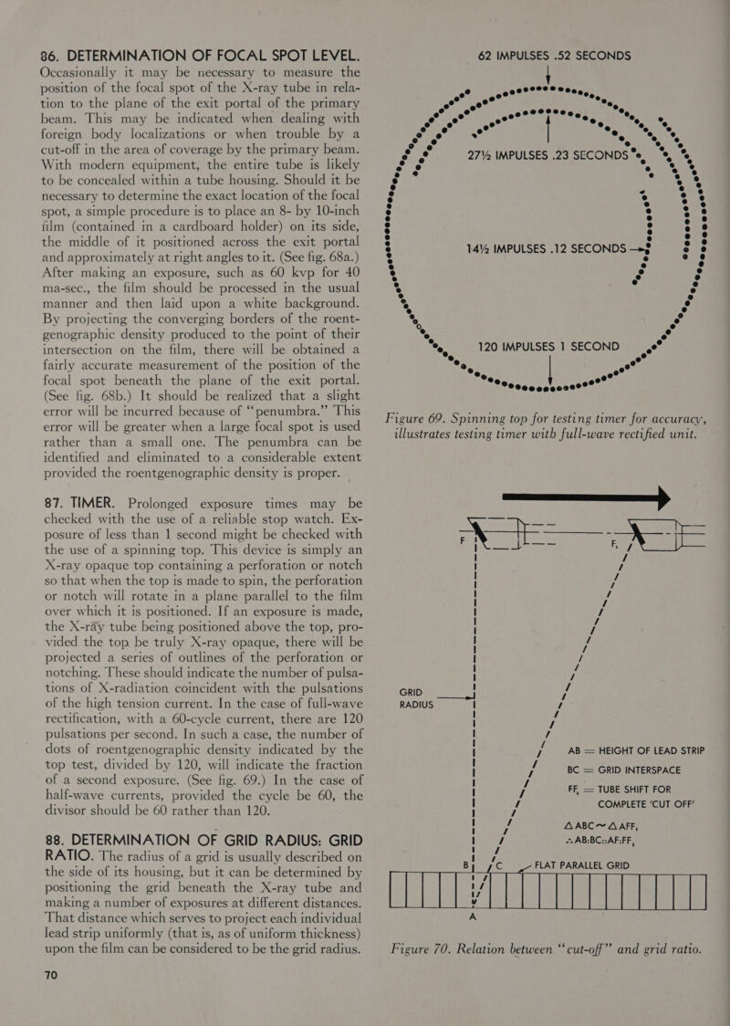 86. DETERMINATION OF FOCAL SPOT LEVEL. Occasionally it may be necessary to measure the position of the focal spot of the X-ray tube in rela- tion to the plane of the exit portal of the primary beam. This may be indicated when dealing with foreign body localizations or when trouble by a cut-off in the area of coverage by the primary beam. With modern equipment, the entire tube is likely to be concealed within a tube housing. Should it be necessary to determine the exact location of the focal spot, a simple procedure is to place an 8- by 10-inch film (contained in a cardboard holder) on its side, the middle of it positioned across the exit portal and approximately at right angles to it. (See fig. 68a.) After making an exposure, such as 60 kvp for 40 ma-sec., the film should be processed in the usual manner and then laid upon a white background. By projecting the converging borders of the roent- genographic density produced to the point of their intersection on the film, there will be obtained a fairly accurate measurement of the position of the focal spot beneath the plane of the exit portal. (See fig. 68b.) It should be realized that a slight error will be incurred because of “penumbra.” This error will be greater when a large focal spot is used rather than a small one. The penumbra can be identified and eliminated to a considerable extent provided the roentgenographic density is proper. 87. TIMER. Prolonged exposure times may be checked with the use of a reliable stop watch. Ex- posure of less than 1 second might be checked with the use of a spinning top. This Ade ice is simply an X-ray opaque top containing a perforation or notch so that when the top is made to spin, the perforation or notch will rotate in a plane parallel to the film over which it is positioned. If an exposure is made, the X-ray tube bemg positioned above the top, pro- vided the top be truly X-ray opaque, there will be projected a series of outlines of the perforation or notching. These should indicate the number of pulsa- tions of X-radiation coincident with the pulsations of the high tension current. In the case of full-wave rectification, with a 60-cycle current, there are 120 pulsations per second. In such a case, the number of dots of roentgenographic density indicated by the top test, divided by 120, will indicate the fraction of a second exposure. (See fig. 69.) In the case of half-wave currents, provided the cycle be 60, the divisor should be 60 rather than 120. 88. DETERMINATION OF GRID RADIUS: GRID RATIO. The radius of a grid is usually described on the side of its housing, but it can be determined by positioning the grid beneath the X-ray tube and making a number of exposures at different distances. That distance which serves to project each individual lead strip uniformly (that is, as of uniform thickness) upon the film can be considered to be the grid radius. 70 62 IMPULSES .52 SECONDS eo? m4 00 eee Meee, Pda at ®e, eo” .* ote eee, *e, ° ” 6° ee” Md * % ° x .° °, *e * o e *. e ¢ 2° 27% IMPULSES .23 SECONDS“, *e, % 2 ¢ . 4% e * % H * ° % e C] ete ° @ $e : 3 638 e e e e @ $ 14% IMPULSES .12 SECONDS» 8 : $ : : ° é .. ° * : Cx A e e % Ad e ) 120 IMPULSES 1 SECOND ge® *eg °° Figure 69. Spinning top for testing timer for accuracy, illustrates testing timer with full-wave rectified unit. SE / AB = HEIGHT OF LEAD STRIP / BC = GRID INTERSPACE / FF, = TUBE SHIFT FOR / COMPLETE ‘CUT OFF’ / AABC~ A AFF, / ae AB:BC::AF:FF, FLAT PARALLEL GRID.   “cut-off” and grid ratio.