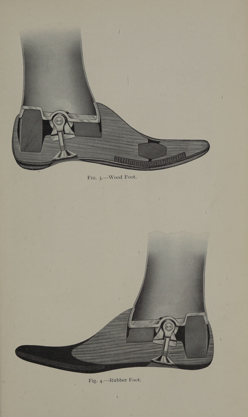 Fic. 3.—Wood Foot.