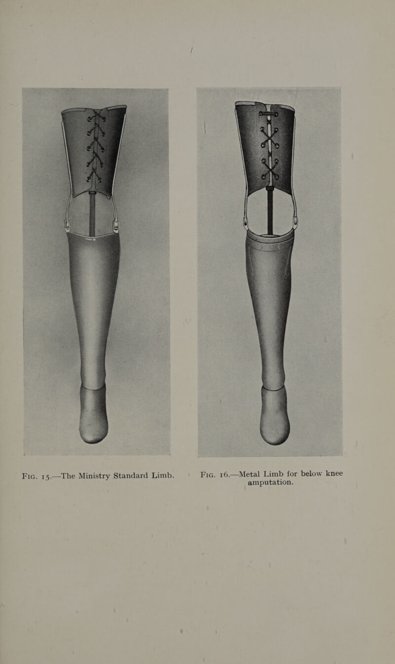 ae Fic. 15.—The Ministry Standard Limb. Fic. 16.—Metal Limb for below knee amputation.
