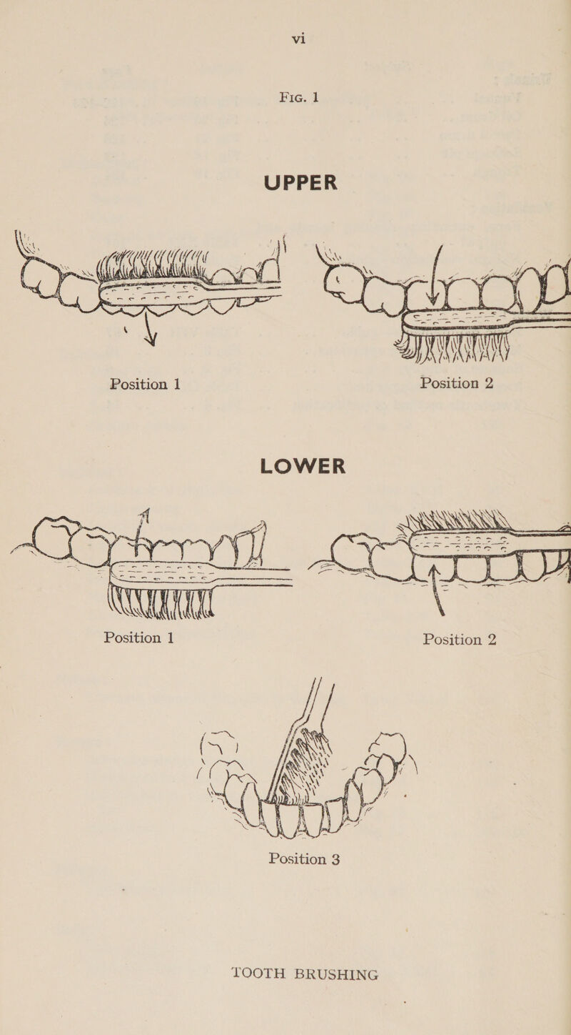  Position 1 Position 2  Position 1 Position 2  LOOTH BRUSHING