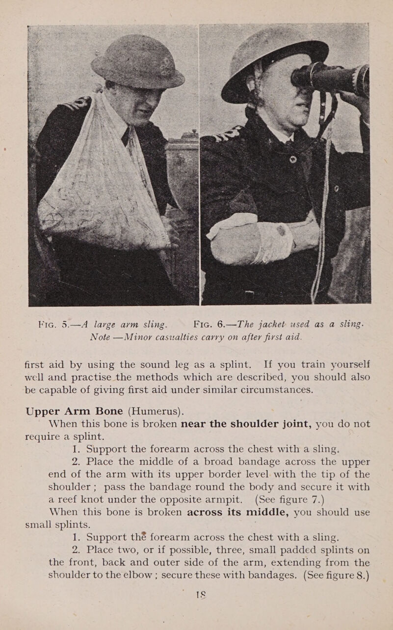  Fic. 5.  first aid by using the sound leg as a splint. If you train yourself well and practise the methods which are described, you should also be capable of giving first aid under similar circumstances. Upper Arm Bone (Humerus). When this bone is broken near the shoulder joint, you do not require a splint. I. Support the forearm across the chest with a sling. 2. Place the middle of a broad bandage across the upper end of the arm with its upper border level with the tip of the shoulder ; pass the bandage round the body and secure it with a reef knot under the opposite armpit. (See figure 7.) When this bone is broken across its middle, you should use small splints. 1. Support thé forearm across the chest with a sling. 2. Place two, or if possible, three, small padded splints on the front, back and outer side of the arm, extending from the shoulder to the elbow ; secure these with bandages. (See figure 8.) 1s