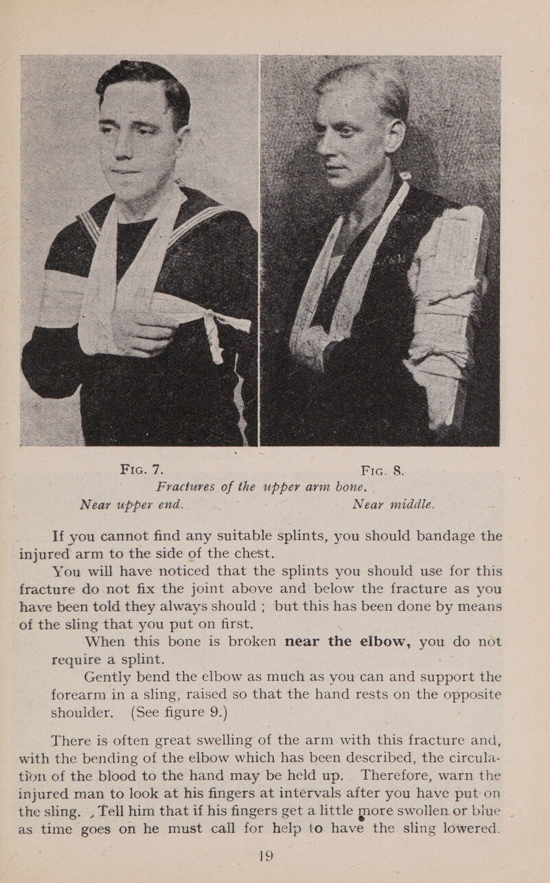  If you cannot find any suitable splints, you should bandage the injured arm to the side of the chest. You will have noticed that the splints you should use for this fracture do not fix the joint above and below the fracture as you have been told they always should ; but this has been done by means -of the sling that you put on first. When this bone is broken near the elbow, you do not require a splint. Gently bend the elbow as much as you can and support the forearm in a sling, raised so that the hand rests on the opposite oD) shoulder. (See figure 9.) There is often great swelling of the arm with this fracture and, with the bending of the elbow which has been described, the circula- tion of the blood to the hand may be held up. Therefore, warn the injured man to look at his fingers at intervals after you have put on the sling. , Tell him that if his fingers get a little more swollen or blue as time goes on he must call for help to have the sling lowered.