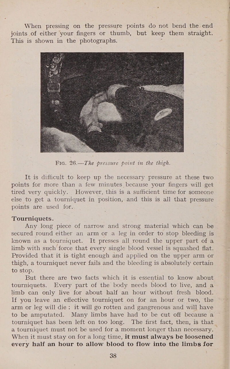 When pressing on the pressure points do not bend the end joints of either your fingers or thumb, but So them straight. This is shown in the photographs.  It is difficult to keep up the necessary pressure at these two points for more than a few minutes because your fingers will get tired very quickly. However, this is a sufficient time for someone else to get a tourniquet in position, and this is all that pressure points are. used for.. Tourniquets. Any long piece of narrow and strong material which can be secured round either an arm or a leg in order to stop bleeding is known as a tourniquet. It presses all round the upper part of a limb with such'force that every single blood vessel is squashed flat. Provided that it is tight enough and applied on the upper arm or thigh, a tourniquet never fails and the bleeding is absolutely certain to stop. But there are two facts which it is essential to know about tourniquets. Every part of the body needs blood to live, and a limb can only live for about half an hour without fresh blood. If you: leave an effective tourniquet on for an hour or two, the arm or leg will die: it will go rotten and gangrenous and will have to be amputated. Many limbs have had to be cut off because a tourniquet has been left on too long. The first fact, then, is that a tourniquet must not be used for a moment longer than necessary. When it must stay on for a long time, it must always be loosened every half an hour to. allow blood to flow into the limbs for