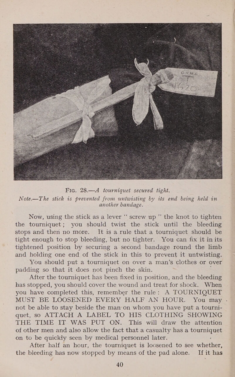  Now, using the stick as a lever “‘ screw up ” the knot to tighten the tourniquet; you should twist the stick until the bleeding stops and then no more. It is a rule that a tourniquet should be tight enough to stop bleeding, but no tighter. You can fix it in its tightened position by securing a second bandage round the limb and holding one end of the stick in this to prevent it untwisting. You should put a tourniquet on over a man’s clothes or over padding so that it does not pinch the skin. ; After the tourniquet has been fixed in position, and the bleeding has stopped, you should cover the wound and treat for shock. When you have completed this, remember the rule: A TOURNIQUET MUST BE: LOOSENED “EVERY HALF.AN HOURS You=may. not be able to stay beside the man on whom you have put a tourni- quet, so ATTACH A LABEL TO HIS CLOTHING SHOWING THE TIME IT WAS PUT ON. This will draw the attention of other men and also allow the fact that a casualty has a tourniquet on to be quickly seen by medical personnel later. . After half an hour, the tourniquet is loosened to see whether, the bleeding has now stopped by means of the pad alone. If it has