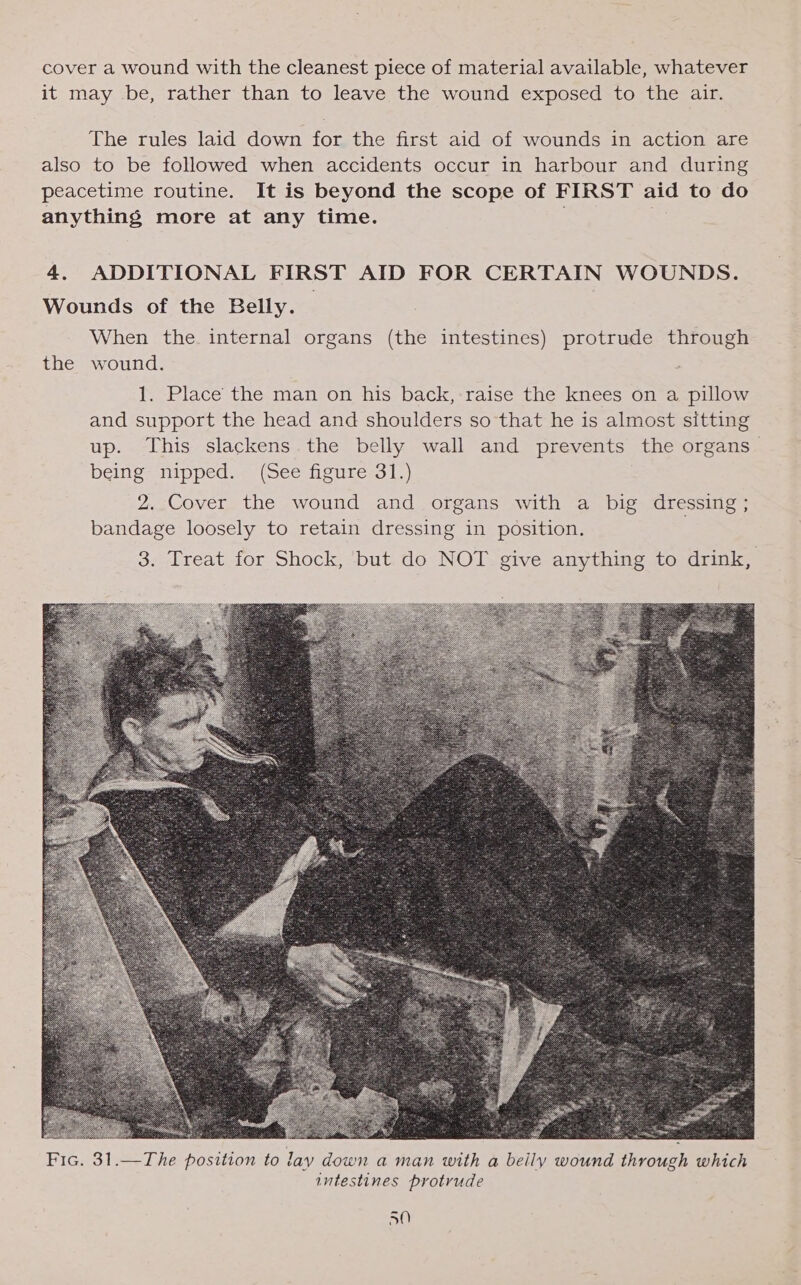 cover a wound with the cleanest piece of material available, whatever it may be, rather than to leave the wound exposed to the air. The rules laid down for the first aid of wounds in action are also to be followed when accidents occur in harbour and during peacetime routine. It is beyond the scope of FIRST aid to do anything more at any time. 4. ADDITIONAL FIRST AID FOR CERTAIN WOUNDS. Wounds of the Belly. When the. internal organs (the intestines) protrude through the wound. 1. Place the man on his back, raise the knees on a pillow and support the head and shoulders so that he is almost sitting up. This slackens the belly wall and prevents the organs being: nipped. (See figure’31.) 2. Cover the wound and organs with a big dressing ; bandage loosely to retain dressing in position, 3. Treat for Shock, but do NOT give anything to drink,   Fic. 31.—The position to lay down a man with a beily wound through which intestines protrude