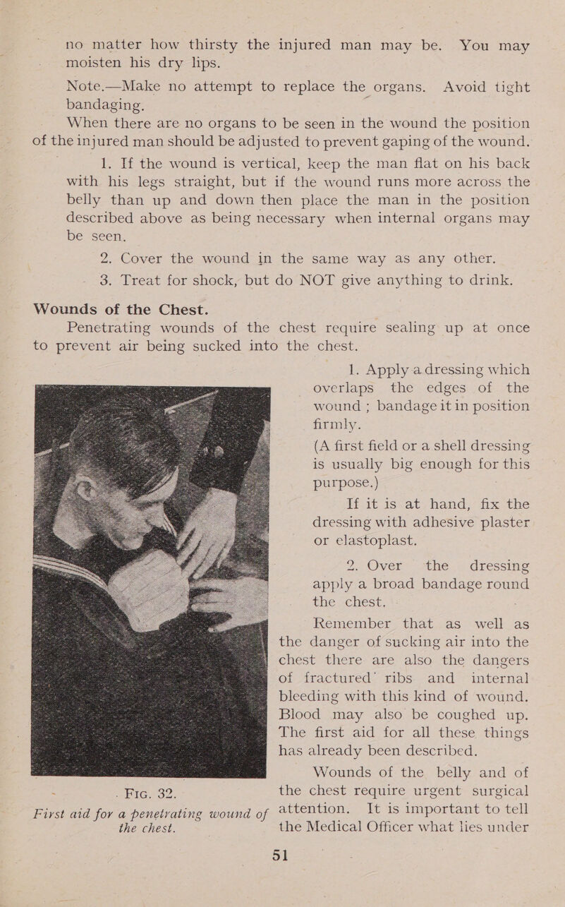 no matter how thirsty the injured man may be. You may moisten his dry lips. Note.—Make no attempt to replace the organs. Avoid tight bandaging. ; When there are no organs to be seen in the wound the position of the injured man should be adjusted to prevent gaping of the wound. 1. If the wound is vertical, keep the man flat on his back with his legs straight, but if the wound runs more across the belly than up and down then place the man in the position described above as being necessary when internal organs may be seen. 2. Cover the wound in the same way as any other. 3. Treat for shock, but do NOT give anything to drink. Wounds of the Chest. Penetrating wounds of the chest require sealing: up at once to prevent air being sucked into the chest. 1. Apply a dressing which overlaps - the: edges; of .the wound ; bandage it in position firmly. (A first field or a shell dressing is usually big enough for this purpose.) Feit 1ssats hand: ix the dressing with adhesive plaster or elastoplast. 2. Over” Ahe... dressing apply a broad bandage round thesehest, *: Remember that as well as the danger of sucking air into the chest there are also the dangers of fractured’ ribs and _ internal bleeding with this kind of wound. Blood may also be coughed up. The first aid for all these things has already been described. 8 Wounds of the belly and of Fic. 32. the chest require urgent surgical  First aid for a penetrating wound of attention. It is important to tell the chest. the Medical Officer what lies under