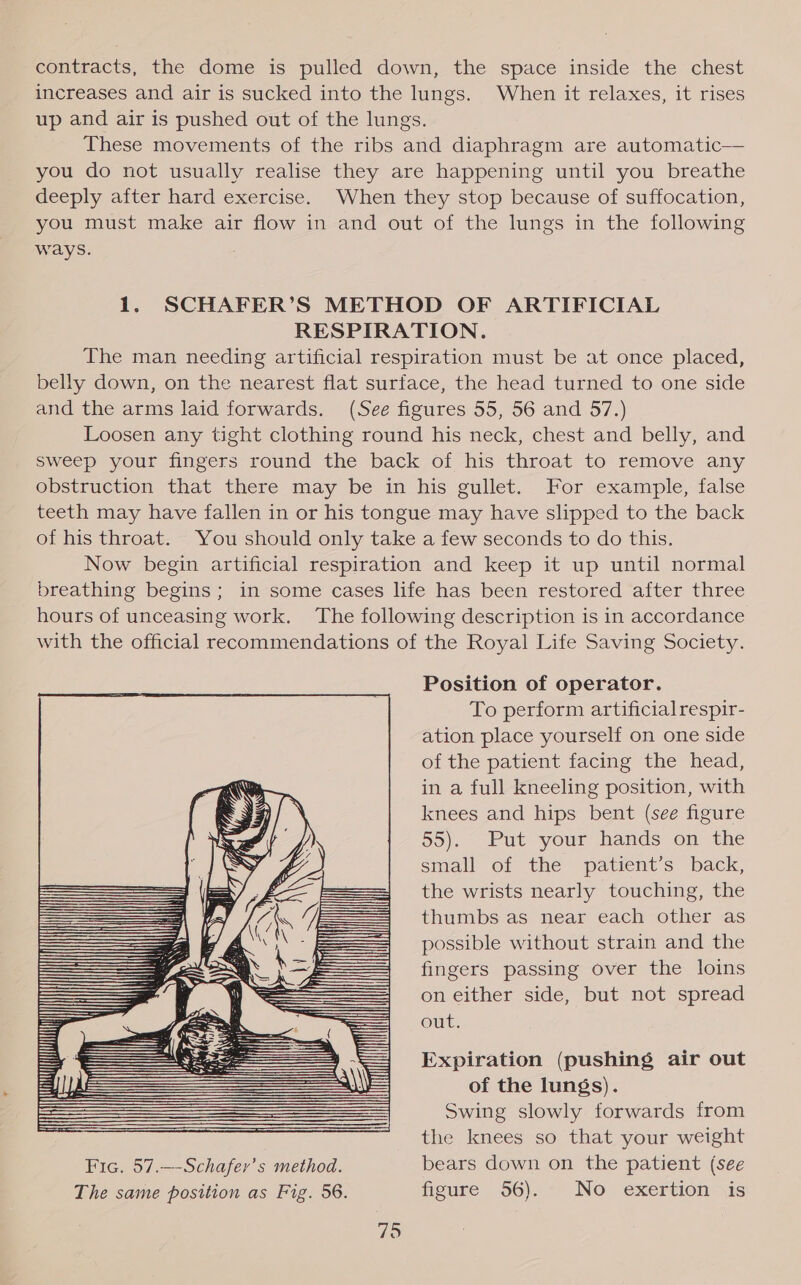 contracts, the dome is pulled down, the space inside the chest increases and air is sucked into the lungs. When it relaxes, it rises up and air is pushed out of the lungs. These movements of the ribs and diaphragm are automatic— you do not usually realise they are happening until you breathe deeply after hard exercise. When they stop because of suffocation, you must make air flow in and out of the lungs in the following ways. 1. SCHAFER’S METHOD OF ARTIFICIAL RESPIRATION. The man needing artificial respiration must be at once placed, belly down, on the nearest flat surface, the head turned to one side and the arms laid forwards. (See figures 55, 56 and 57.) Loosen any tight clothing round his neck, chest and belly, and sweep your fingers round the back of his throat to remove any ebstruction that there may be in his gullet. For example, false teeth may have fallen in or his tongue may have slipped to the back of his throat. You should only take a few seconds to do this. Now begin artificial respiration and keep it up until normal breathing begins; in some cases life has been restored after three hours of unceasing work. The following description is in accordance with the official recommendations of the Royal Life Saving Society. Position of operator. To perform artificial respir- ation place yourself on one side of the patient facing the head, in a full kneeling position, with knees and hips bent (see figure 55). Put your hands on the small of the patient’s back, the wrists nearly touching, the thumbs as near each other as possible without strain and the fingers passing over the loins on either side, but not spread out. Expiration (pushing air out of the lungs). Swing slowly forwards from the knees so that your weight Fic. 57.—-Schafer’s method. bears down on the patient (see The same position as Fig. 56. figure 56). No exertion is 79 