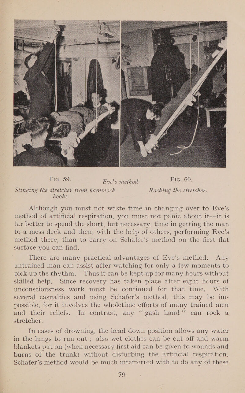  Slinging the stretcher from hammock Rocking the stretcher. hooks Although you must not waste time in changing over to Eve’s method of artificial respiration, you must not panic about it-—it is tar better to spend the short, but necessary, time in getting the man to a mess deck and then, with the help of others, performing Eve’s method there, than to carry on Schafer’s method on the first flat surface you can find. There are many practical advantages of Eve’s method. Any untrained man can assist after watching for only a few moments to pickup the rhythm. Thus it can be kept up for many hours without skilled help. Since recovery has taken place after eight hours of unconsciousness work must be continued for that time. With several casualties and using Schafer’s method, this may be im- possible, for it involves the wholetime efforts of many trained men anc their reliets. In comtrast, any ~ gash hand’ can.rock a Stretcher. In cases of drowning, the head down position allows any water in the lungs to run out; also wet clothes can be cut off and warm blankets put on (when necessary first aid can be given to wounds and burns of the trunk) without disturbing the artificial respiration. Schafer’s method would be much interferred with to do any of these