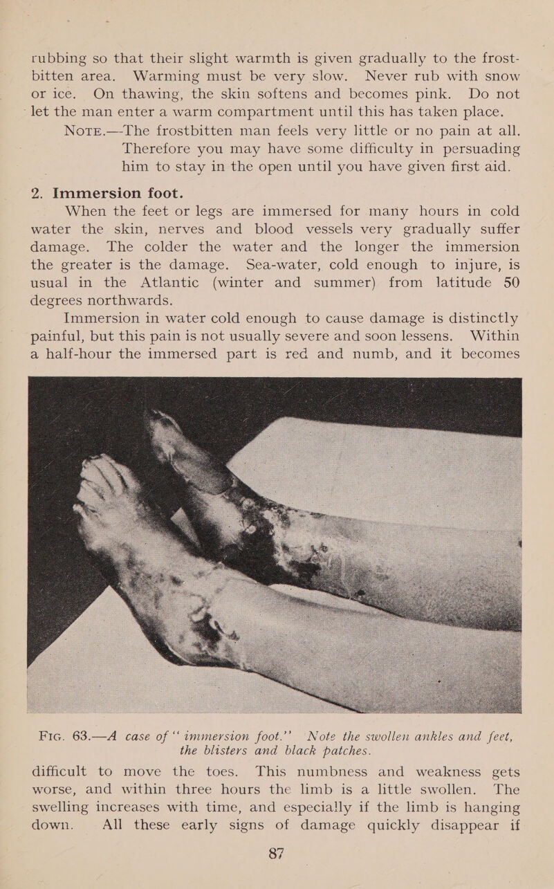 rubbing so that their sight warmth is given gradually to the frost- bitten area. Warming must be very slow. Never rub with snow or ice. On thawing, the skin softens and becomes pink. Do not ‘let the man enter a warm compartment until this has taken place. Notre.—-The frostbitten man feels very little or no pain at all. Therefore you may have some difficulty in persuading him to stay in the open until you have given first aid. 2. Immersion foot. When the feet or legs are immersed for many hours in cold water the skin, nerves and blood vessels very gradually suffer damage. The colder the water and the longer the immersion the greater is the damage. Sea-water, cold enough to injure, is usual in the Atlantic (winter and summer) from latitude 50 degrees northwards. Immersion in water cold enough to cause damage is distinctly painful, but this pain is not usually severe and soon lessens. Within a half-hour the immersed part is red and numb, and it becomes  Fic. 63.—A case of ‘‘ immersion foot.’’ ‘Note the swollen ankles and feet, the blisters and black patches. difficult to move the toes. This numbness and weakness gets worse, and within three hours the limb is a little swollen. The swelling increases with time, and especially if the limb is hanging down. All these early signs of damage quickly disappear if