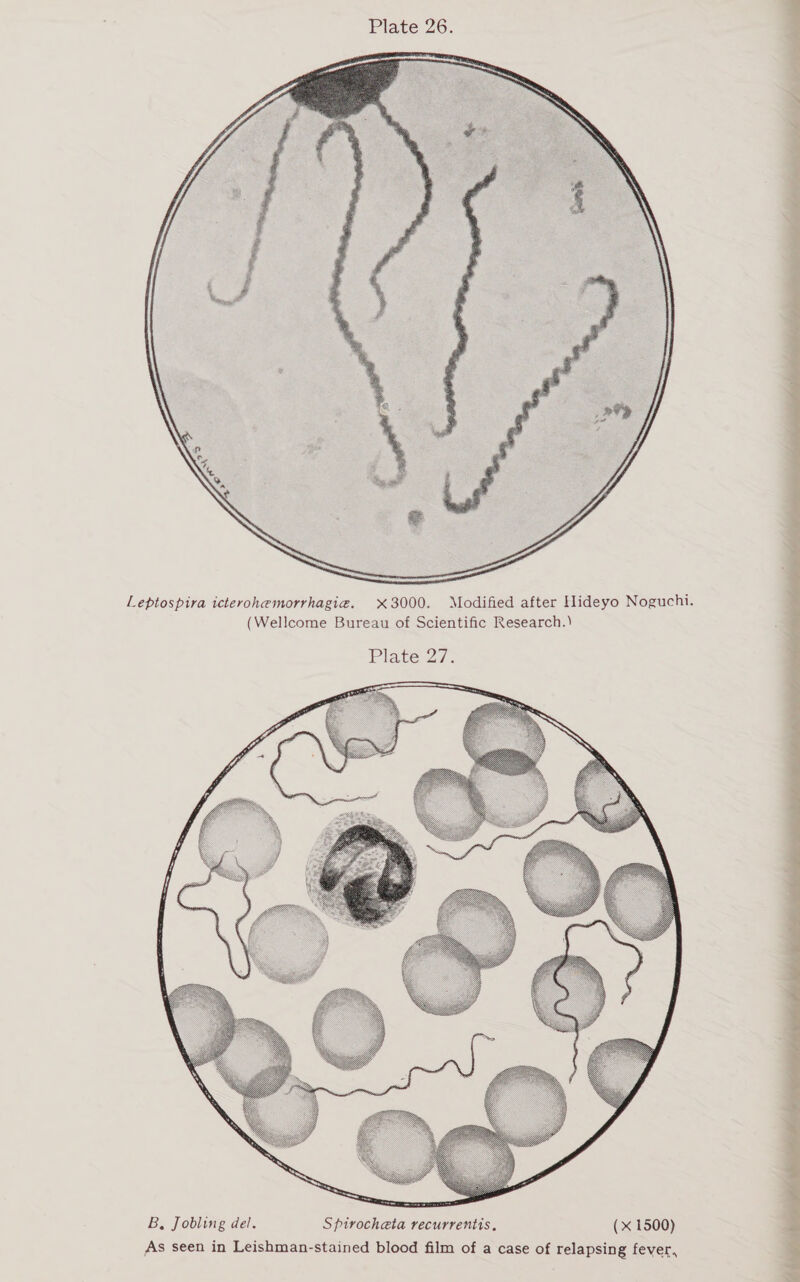  Leptospira icterohemorrhagig. X3000. Modified after Hideyo Noguchi. (Wellcome Bureau of Scientific Research.) Plate-27-  B, Jobling del. Spirocheta recurrentis. (x 1500) As seen in Leishman-stained blood film of a case of relapsing fever, 