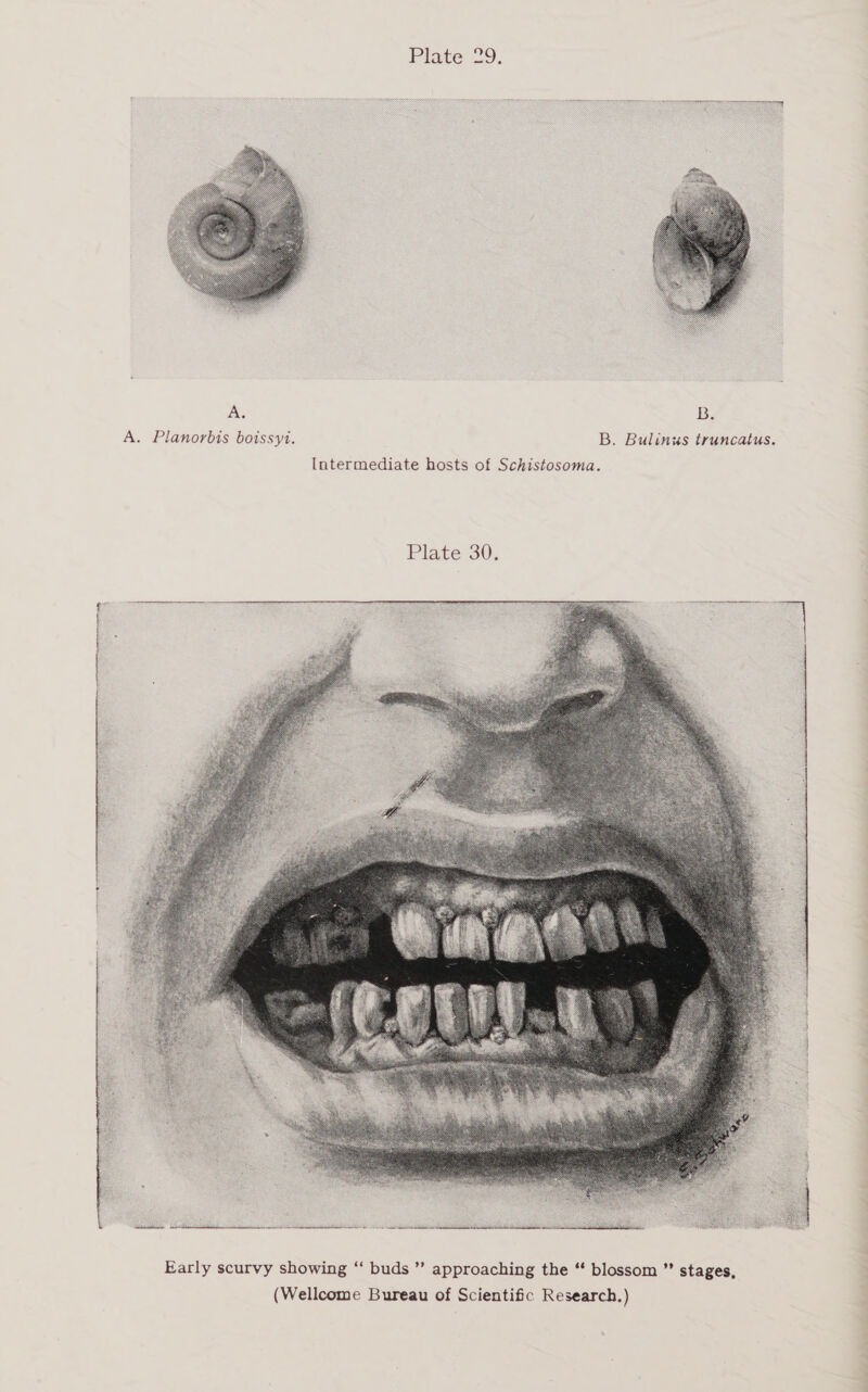   A. B. A. Planorbis boissyi. B. Bulinus truncatus. Intermediate hosts of Schistosoma. Plate 30; aren tee tte (a  