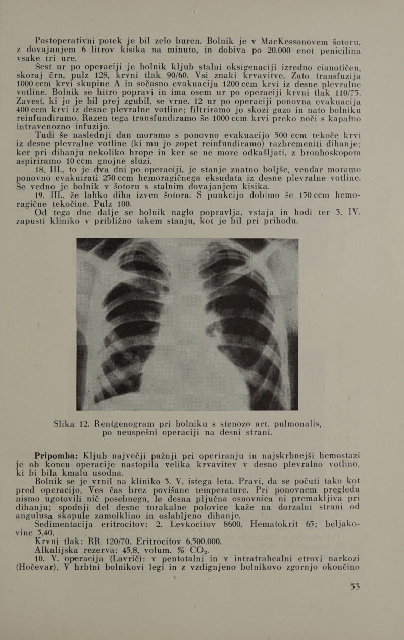z dovajanjem 6 litrov kisika na minuto, in dobiva po 20.000 enot penicilina vsake tri ure. Šest ur po operaciji je bolnik kljub stalni oksigenaciji izredno cianotičen, skoraj črn, pulz 128, krvni tlak 90/60. Vsi znaki krvavitve. Zato transfuzija 1000 ccm krvi skupine A in sočasno evakuacija 1200 ccm krvi iz desne plevralne votline. Bolnik se hitro popravi in ima osem ur po operaciji krvni tlak 110/75. Zavest, ki jo je bil prej zgubil, se vrne. 12 ur po operaciji ponovna evakuacija 400 ccm krvi iz desne plevralne votline; filtriramo jo skozi gazo in nato bolniku reinfundiramo. Razen tega transfundiramo še 1000 ccm krvi preko noči s kapalno intravenozno infuzijo. Tudi še naslednji dan moramo s ponovno evakuacijo 500 cem tekoče krvi iz desne plevralne votline (ki mu jo zopet reinfundiramo) razbremeniti dihanje; ker pri dihanju nekoliko hrope in ker se ne more odkašljati, z bronhoskopom aspiriramo 10 ccm gnojne sluzi. 18. IIL., to je dva dni po operaciji, je stanje znatno boljše, vendar moramo ponovno evakuirati 250 ccm hemoragičnega eksudata iz desne plevralne votline. Še vedno je bolnik v šotoru s stalnim dovajanjem kisika. 19. IIL., že lahko diha izven šotora. S punkcijo dobimo še 150 ccm hemo- ragične tekočine. Pulz 100. Od tega dne dalje se bolnik naglo popravlja, vstaja in hodi ter 5. IV. zapusti kliniko v približno takem stanju, kot je bil pri prihodu.  Slika 12. Rentgenogram pri bolniku s stenozo art. pulmonalis, po neuspešni operaciji na desni strani. Pripomba: Kljub največji pažnji pri operiranju in najskrbnejši hemostazi je ob koncu operacije nastopila velika krvavitev v desno plevralno votlino, ki bi bila kmalu usodna. Bolnik se je vrnil na kliniko 3. V. istega leta. Pravi, da se počuti tako kot pred operacijo. Ves čas brez povišane temperature. Pri ponovnem pregledu nismo ugotovili nič posebnega, le desna pljučna osnovnica ni premakljiva pri dihanju; spodnji del desne torakalne polovice kaže na dorzalni strani od angulusa skapule zamolklino in oslabljeno dihanje. Sedimentacija eritrocitov: 2. Levkocitov 8600. Hematokrit 65; beljako- vine 5,40. : Krvni tlak: RR 120/70. Eritrocitov 6,500.000. Alkalijska rezerva: 45.8, volum. % CO». 10. V. operacija (Lavrič): v pentotalni in v intratrahealni etrovi narkozi (Hočevar). V hrbtni bolnikovi legi in z vzdignjeno bolnikovo zgornjo okončino D3